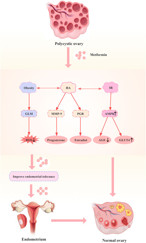 Diagram illustrating the effects of metformin on polycystic ovary syndrome (PCOS). It shows a polycystic ovary transforming into a normal ovary, highlighting pathways involving obesity, hyperandrogenism (HA), and insulin resistance (IR). Metformin improves endometrial tolerance and influences hormone levels, decreasing reactive oxygen species (ROS) and advanced glycation end-products (AGE) while increasing AMP-activated protein kinase (AMPK) and glucose transporter type 4 (GLUT4).
