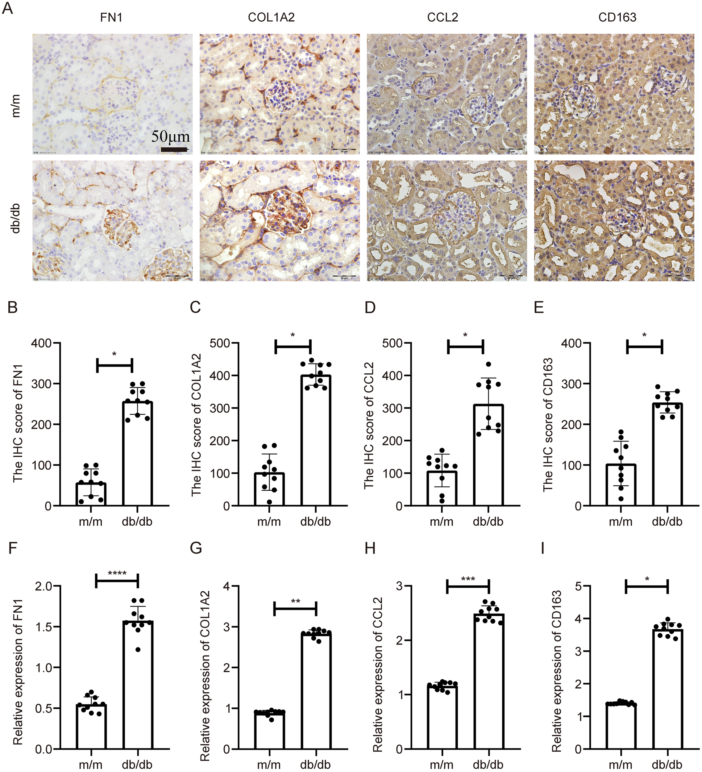 Panel A shows immunohistochemistry of FN1, COL1A2, CCL2, and CD163 in m/m and db/db tissues. Panels B to E display corresponding expression levels, with db/db showing higher values marked by asterisks indicating significance. Panels F to I show mRNA expression levels for each marker, again with higher values in db/db tissues, denoted by asterisks for statistical significance. Bars represent means, and dots represent individual data points. Scale bar in A is 50 micrometers.