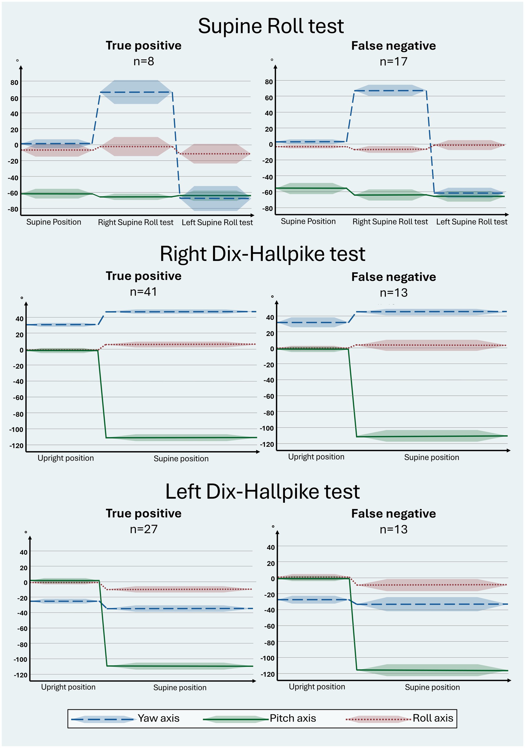 Head orientation-time graphs showing yaw, pitch, and roll axes for Supine Roll test, right Dix-Hallpike test, and left Dix-Hallpike test. Each test show separate true positive and false negative results. Supine Roll test has 8 true positives and 17 false negatives. Right Dix-Hallpike has 41 true positives and 13 false negatives. Left Dix-Hallpike has 27 true positives and 13 false negatives.