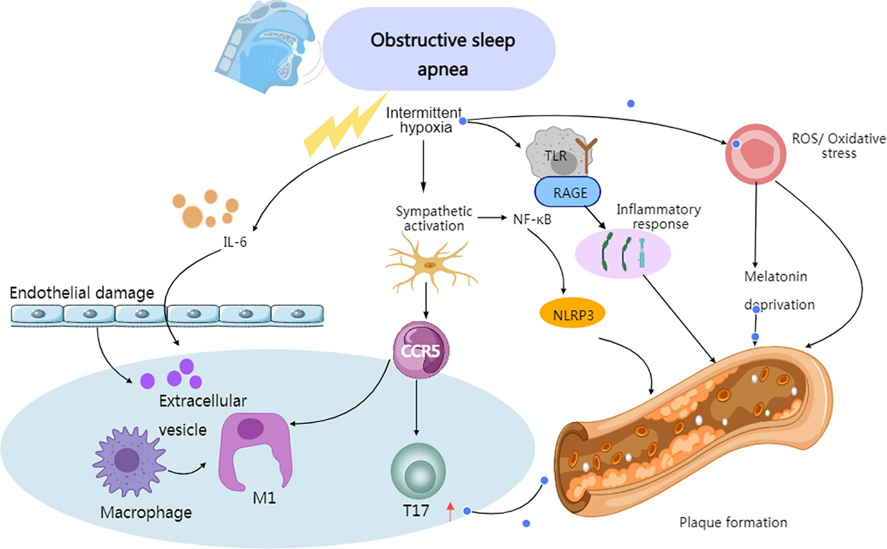 Flowchart illustrating the mechanisms linking obstructive sleep apnea to plaque formation. The chart shows intermittent hypoxia leading to endothelial damage, sympathetic activation, and inflammatory responses. Elements include macrophages, IL-6, CCR5, RAGE, NF-ÎşB, NLRP3, TLR, and oxidative stress, contributing to inflammatory pathways and plaque buildup due to melatonin deprivation.
