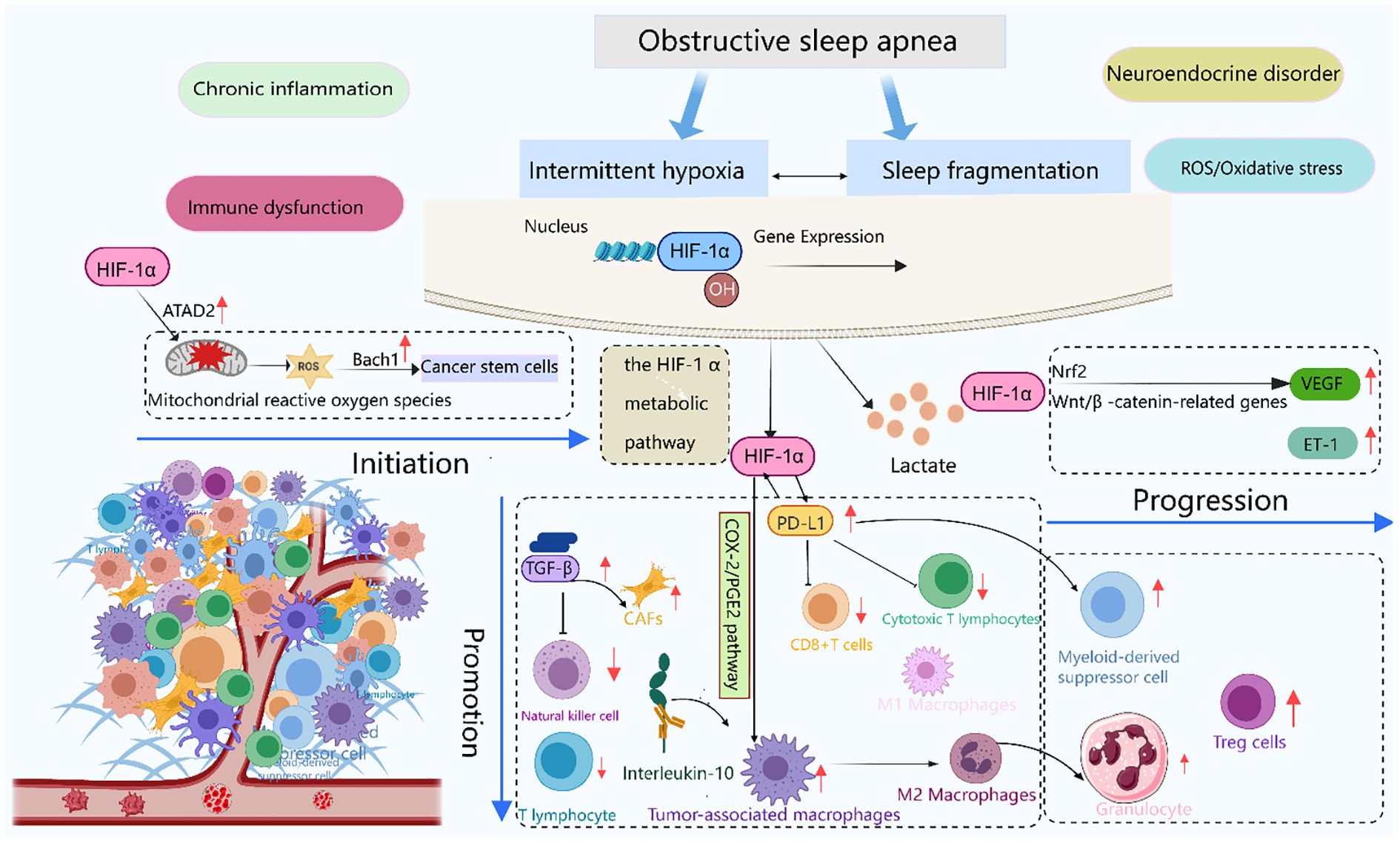 Flowchart illustrating the effects of obstructive sleep apnea. It shows how intermittent hypoxia and sleep fragmentation lead to immune dysfunction, chronic inflammation, and other disorders. The process involves HIF-1α and metabolic pathways, promoting cancer stem cells, mitochondrial reactive oxygen species, neuroendocrine disorder, and oxidative stress. The chart details the initiation, promotion, and progression phases with elements like lymphocytes, lactate, CAFs, and various macrophages contributing to the progression of immune responses and inflammation, impacting pathways like VEGF and ET-1.