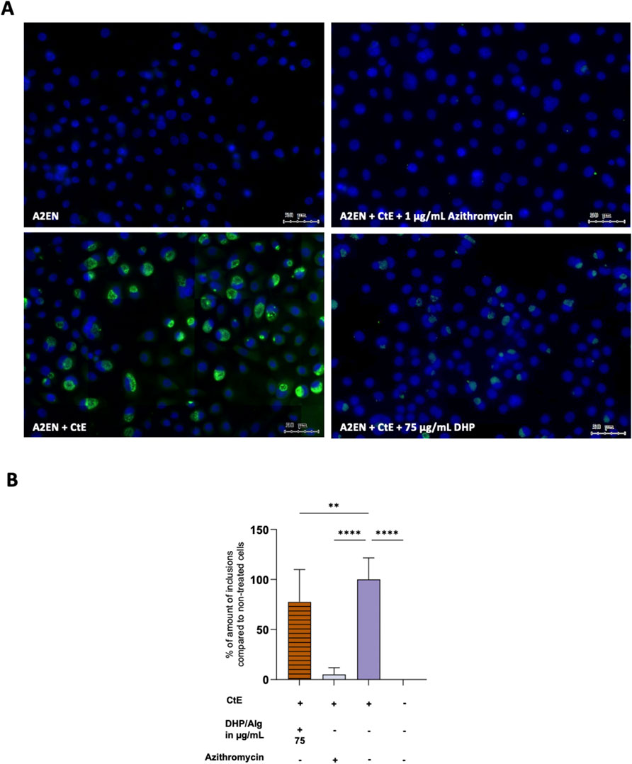 Panel A displays fluorescence microscopy images of cells treated under different conditions: A2EN alone, A2EN with CtE, A2EN with CtE and Azithromycin, and A2EN with CtE and DHP at 75 µg/mL. Blue and green fluorescence indicates cell presence and activity. Panel B is a bar graph showing the percentage of inclusions in treated cells compared to non-treated cells, with different treatment conditions labeled. Statistically significant differences are marked with asterisks.