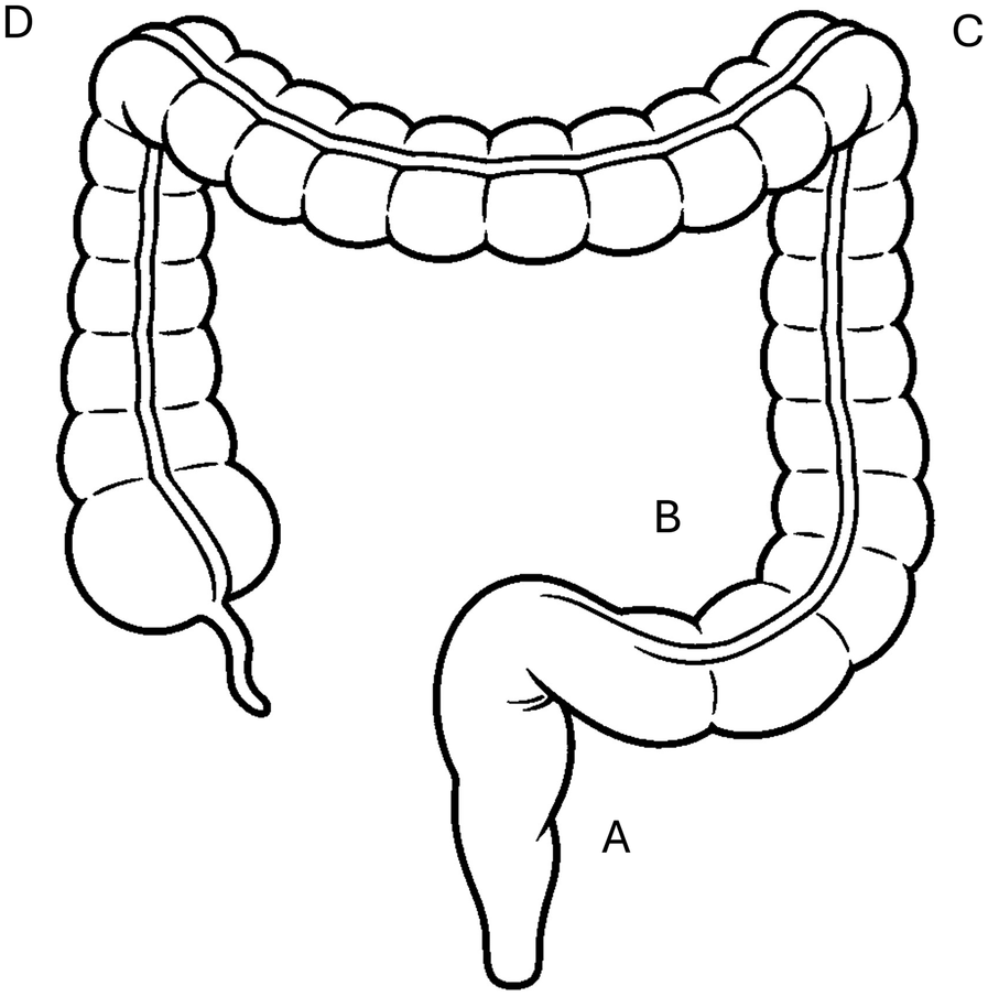 Diagram of the human large intestine showing four sections labeled A, B, C, and D. Section A represents the sigmoid colon, B is the descending colon, C is the transverse colon, and D is the ascending colon.