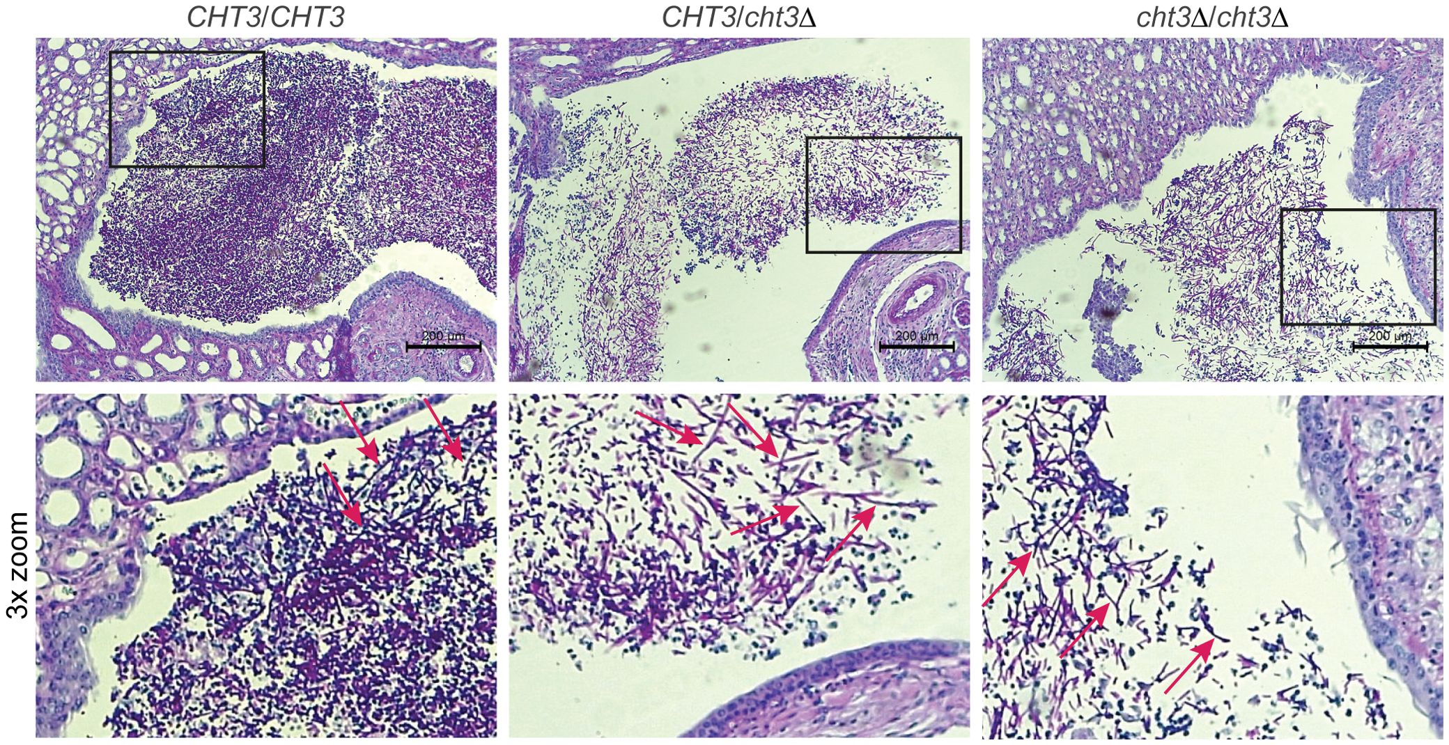 Histological comparison of kidney tissues from mice infected with strains from different genotypes: CHT3/CHT3, CHT3/cht3 Δ, and cht3Δ /cht3Δ. Each top panel shows tissue with a 200 μm scale bar. Black boxes indicate areas magnified below. The bottom row displays 3x zoomed images with red arrows highlighting infecting yeast hyphae.