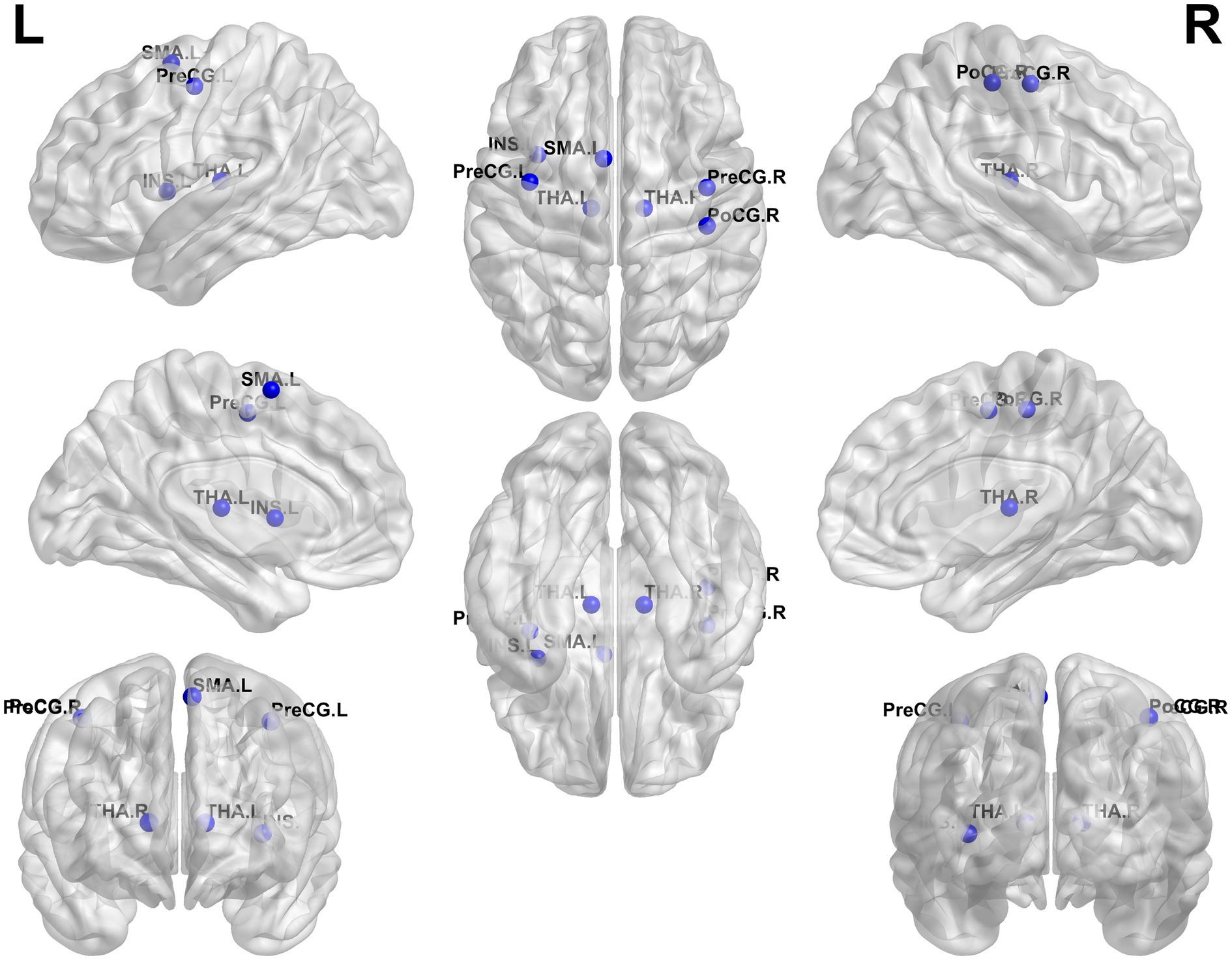 Diagram of brain scans showing different views of the left and right hemispheres. Blue markers indicate specific regions: SMA, PreCG, INS, THA, and PoCG, labeled with left (L) and right (R) designations. The images illustrate lateral, top, and medial perspectives, highlighting the anatomical positions of these regions.