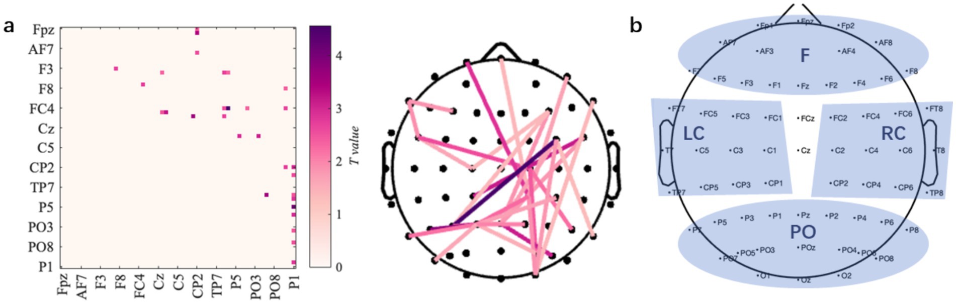 EEG connectivity analysis featuring three panels: (a) a heatmap with pink squares indicating T-values across different EEG channels, (b) a circular diagram showing EEG electrode positions with lines representing connections in varying pink shades, and (c) a head map indicating frontal (F), left central (LC), right central (RC), and parietal occipital (PO) regions.