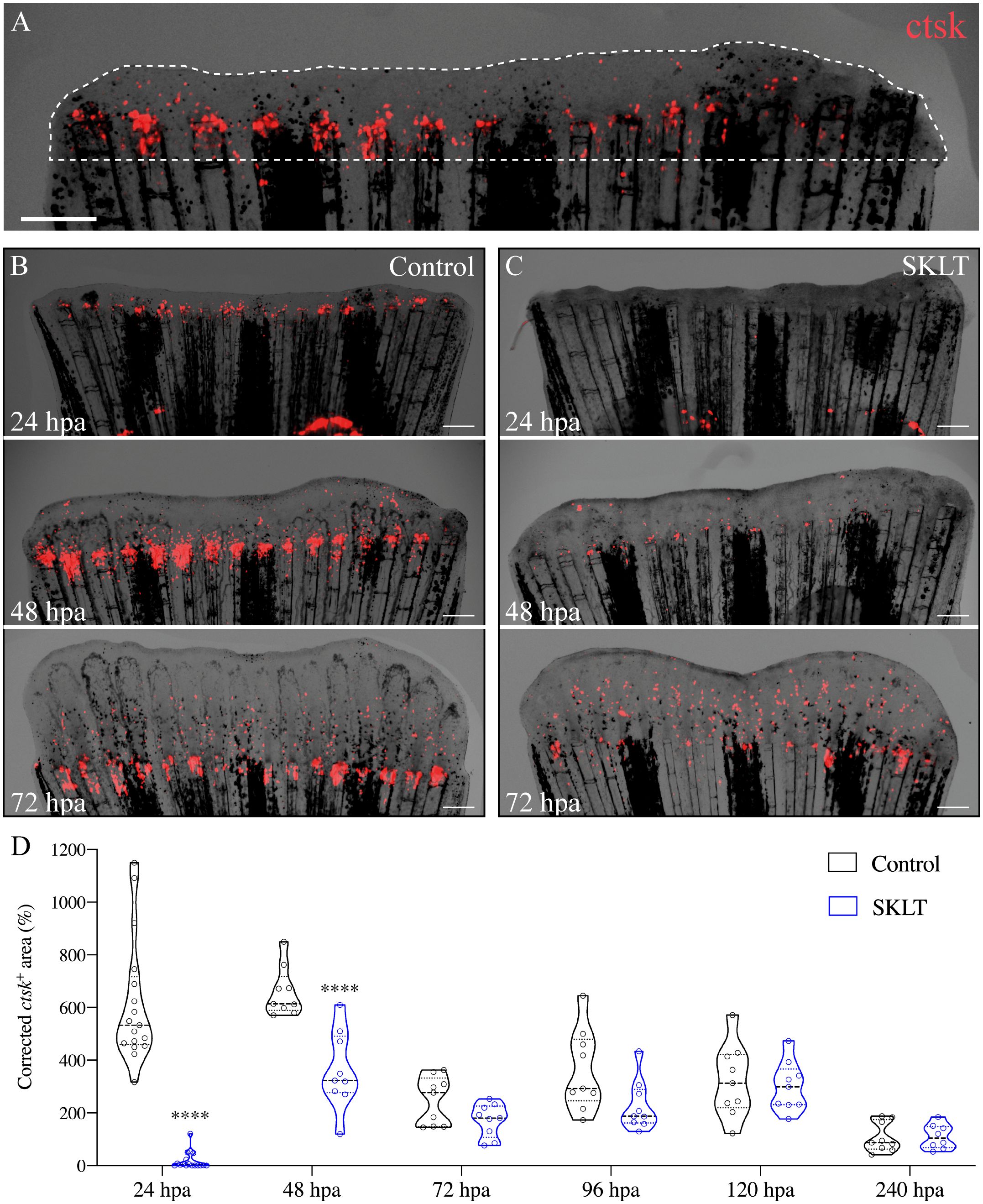 Panel A shows a fluorescent microscopy image highlighting ctsk expression in a sample. Panels B and C compare control and SKLT conditions at 24, 48, and 72 hours post-amputation (hpa), showing red fluorescent areas. Panel D presents a violin plot comparing normalized ctsk positive areas between control and SKLT at multiple time points from 24 to 240 hpa, with significant differences marked at certain time points. Scale bars are present.
