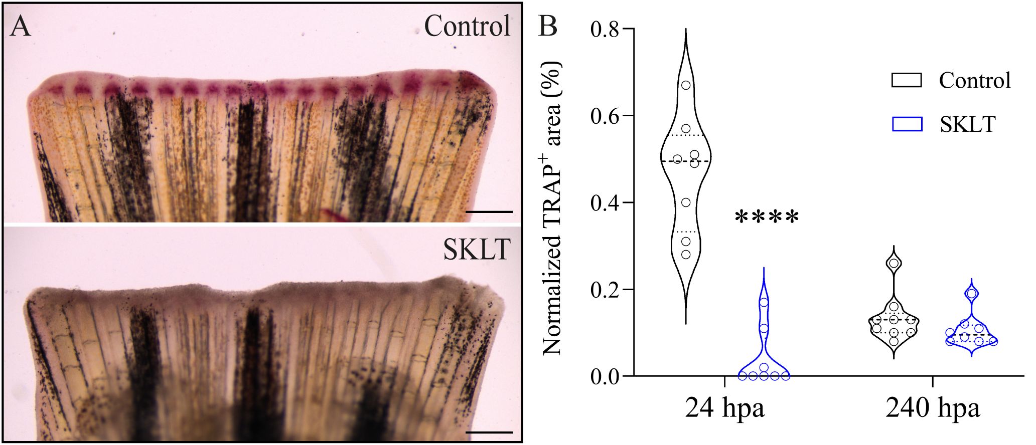 Panel A shows two histological images comparing a control sample and SKLT sample, both highlighting differences in staining patterns and color intensity. Panel B is a violin plot showing the normalized TRAP positive area for control and SKLT at 24 and 240 hours post application (hpa). Control displays wider distribution at both time points, with significant differences indicated at 24 hpa. Control is denoted by black, SKLT by blue.