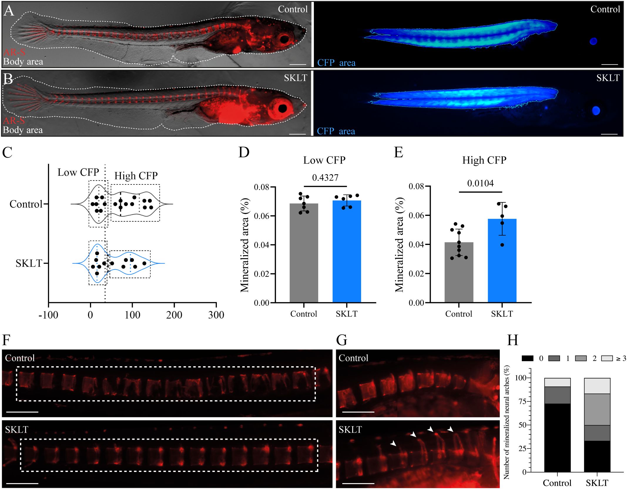 Composite image showing various analyses of fish samples. Panels A and B display fish with areas labeled AR-S and CFP, comparing control and SKLT specimens with red and blue fluorescence. Panel C presents a violin plot of Low and High CFP between control and SKLT groups. Panels D and E show bar graphs of mineralized area percentages with statistical significance. Panels F and G depict magnified sections illustrating mineralization differences in control and SKLT samples. Panel H is a stacked bar chart comparing mineralized neural arches, with key indicating quantities zero to three or more.