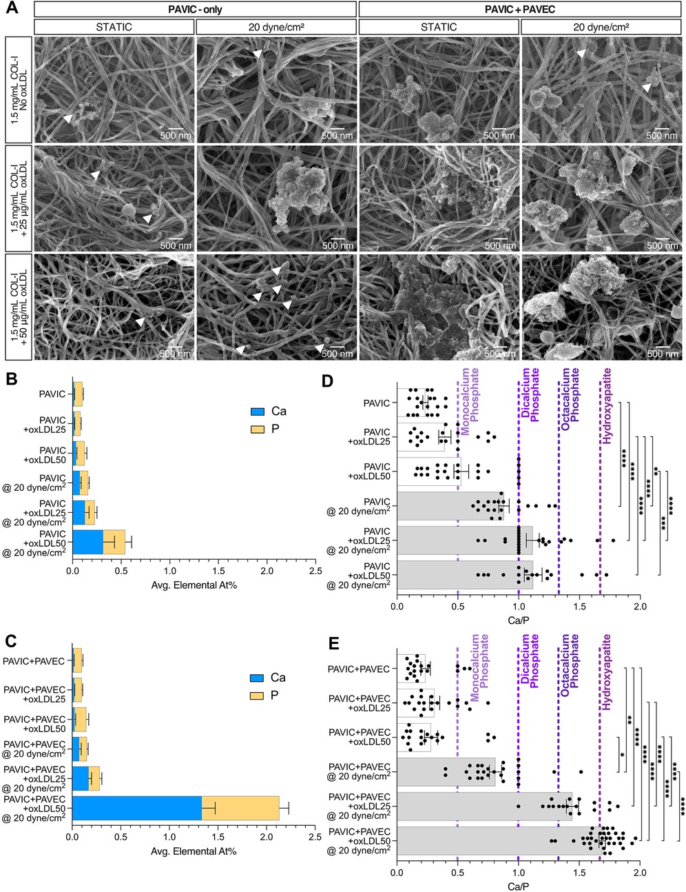 SEM images and bar charts depict calcification in various conditions. Panel A presents SEM images of porcine aortic valve interstitial and endothelial cells under static and shear stress environments with different lipoprotein concentrations, showing structural details at 500 nm scale. Panels B and C display bar charts of average elemental percentages of calcium (Ca) and phosphorus (P) under these conditions. Panels D and E provide scatter plots comparing calcium to phosphorus ratios across conditions, with statistical significance indicated. Graph trends and data points offer insights into calcific nodules and mineral phases in cardiovascular research.