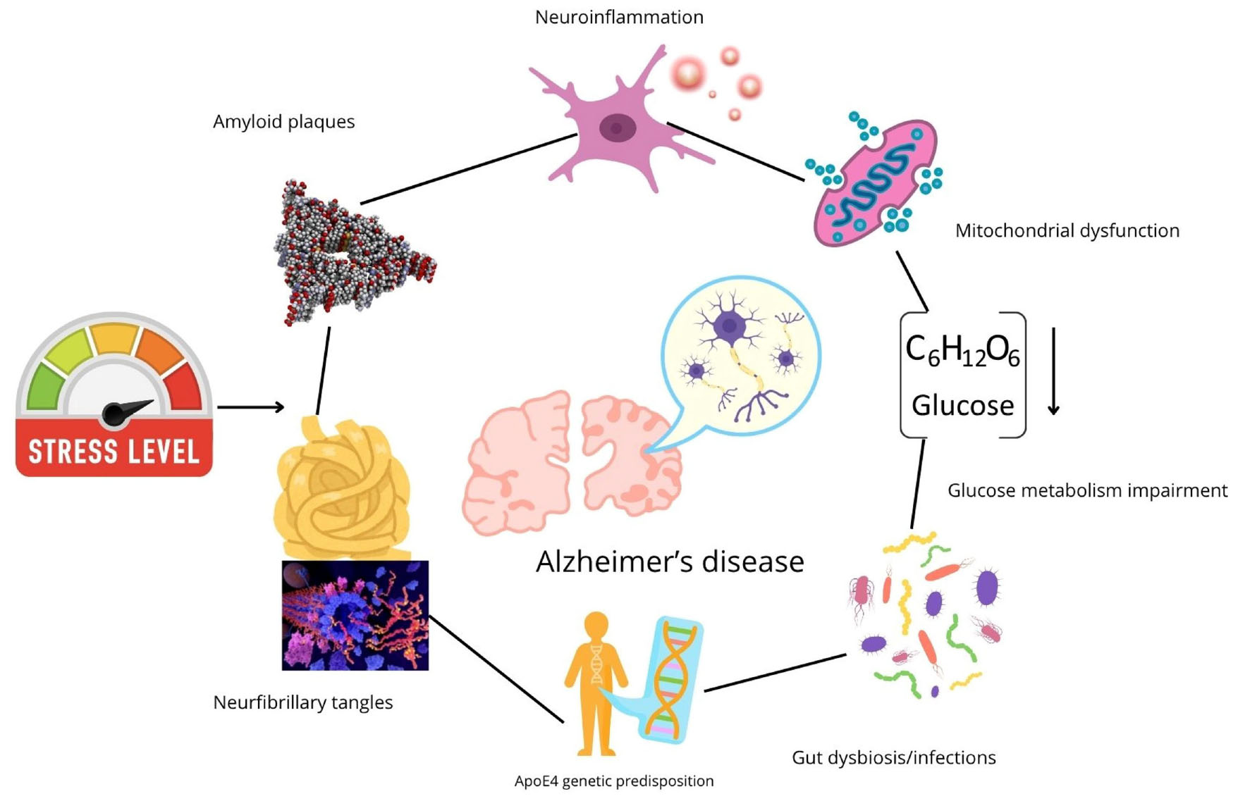 Diagram illustrating factors contributing to Alzheimer’s disease. Central brain image with arrows pointing to various elements: stress level gauge linked to amyloid plaques and neurofibrillary tangles, leading to Alzheimer’s. Mitochondrial dysfunction, glucose metabolism impairment, gut dysbiosis/infections, and ApoE4 genetic predisposition are also connected with Alzheimer’s.