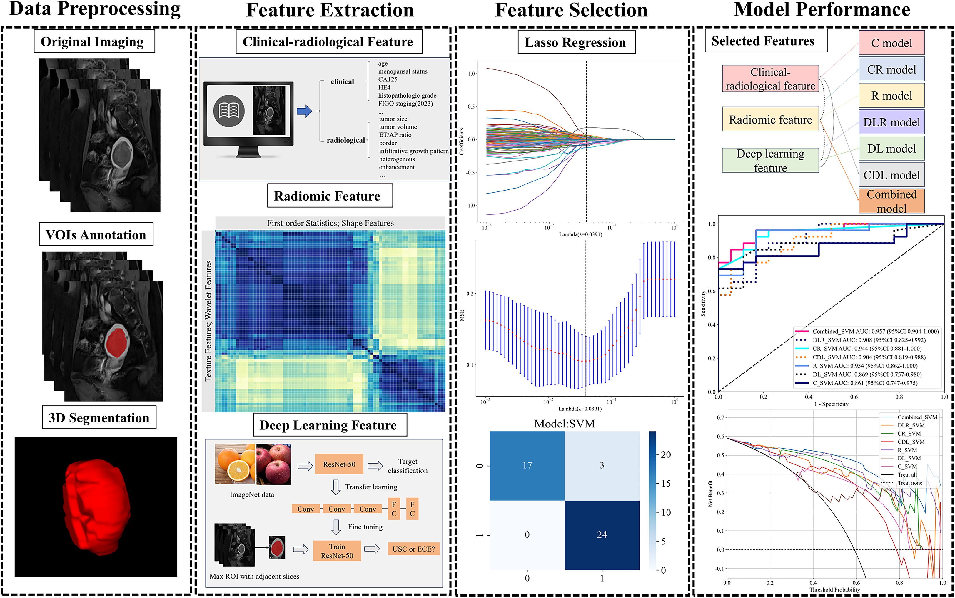 Flowchart depicting a medical imaging analysis process. Four sections: Data Preprocessing shows original imaging and VOIs annotation. Feature Extraction displays clinical-radiological, radiomic, and deep learning features. Feature Selection includes Lasso Regression plots. Model Performance illustrates selected features linking to various models, with ROC curve graphs and model comparison chart.