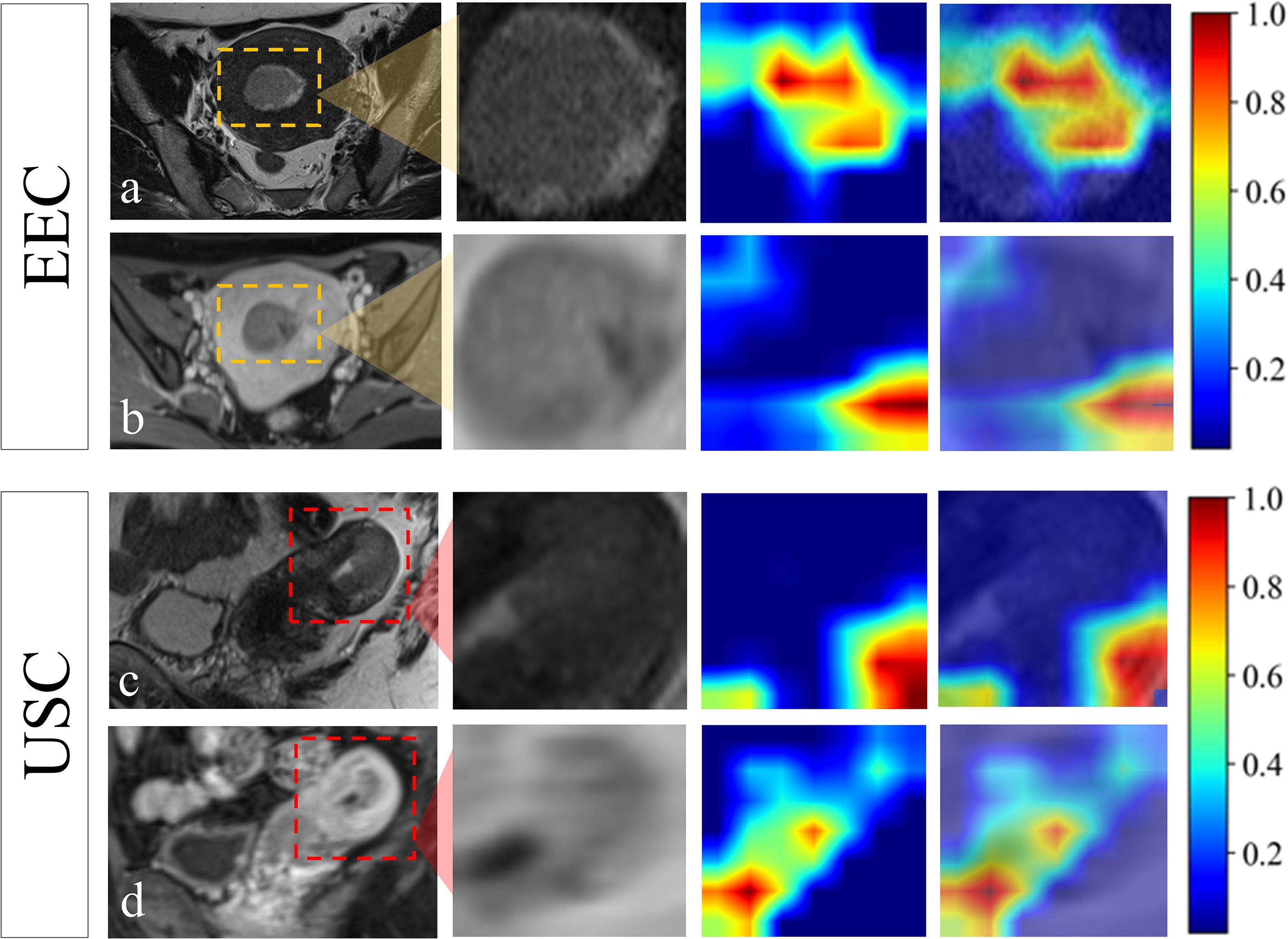 MRI scans in two rows labeled EEC and USC, each containing four columns. First column shows original MRI with marked regions. Second column displays a zoomed section. Third and fourth columns present heat maps of varying color intensity, representing different levels of activity or concentration, with a color scale on the right.