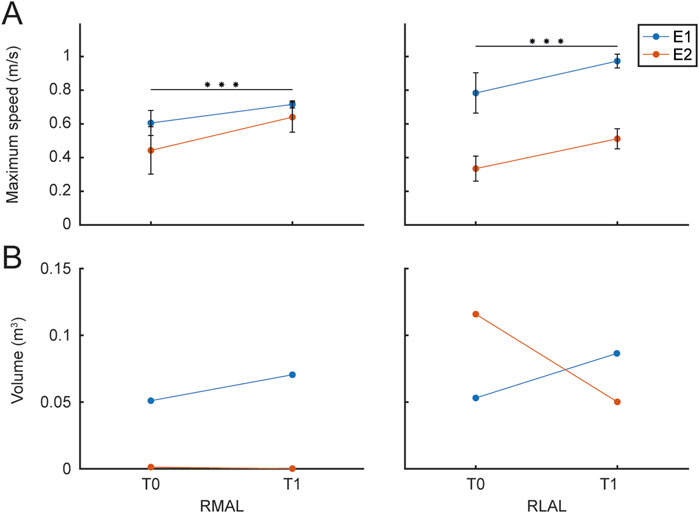 Graphs A and B compare E1 and E2 data over time. In A, maximum speed (in meters per second) is plotted for RMAL (left panel) and RLAL (right panel), showing a significant increase from T0 to T1. In B, movement volume (in cubic meters) is shown, with no significant changes observed for either RMAL or RLAL.