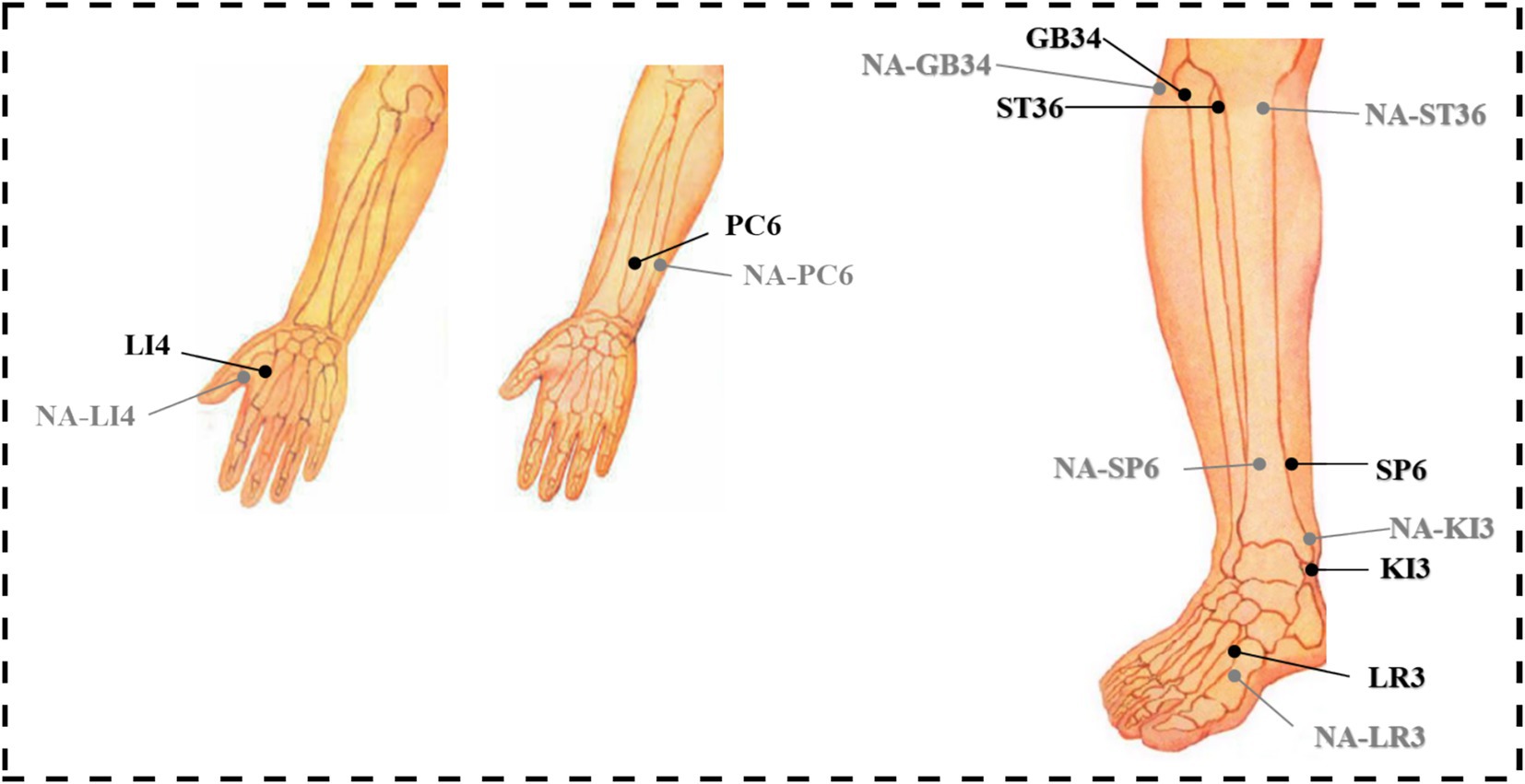 Illustration showing acupuncture points on a human body, focusing on limbs. The left image highlights points LI4 and PC6 on the hand and forearm. The right image shows points GB34, ST36, SP6, KI3, and LR3 on the leg and foot. Each point is labeled with its corresponding name.