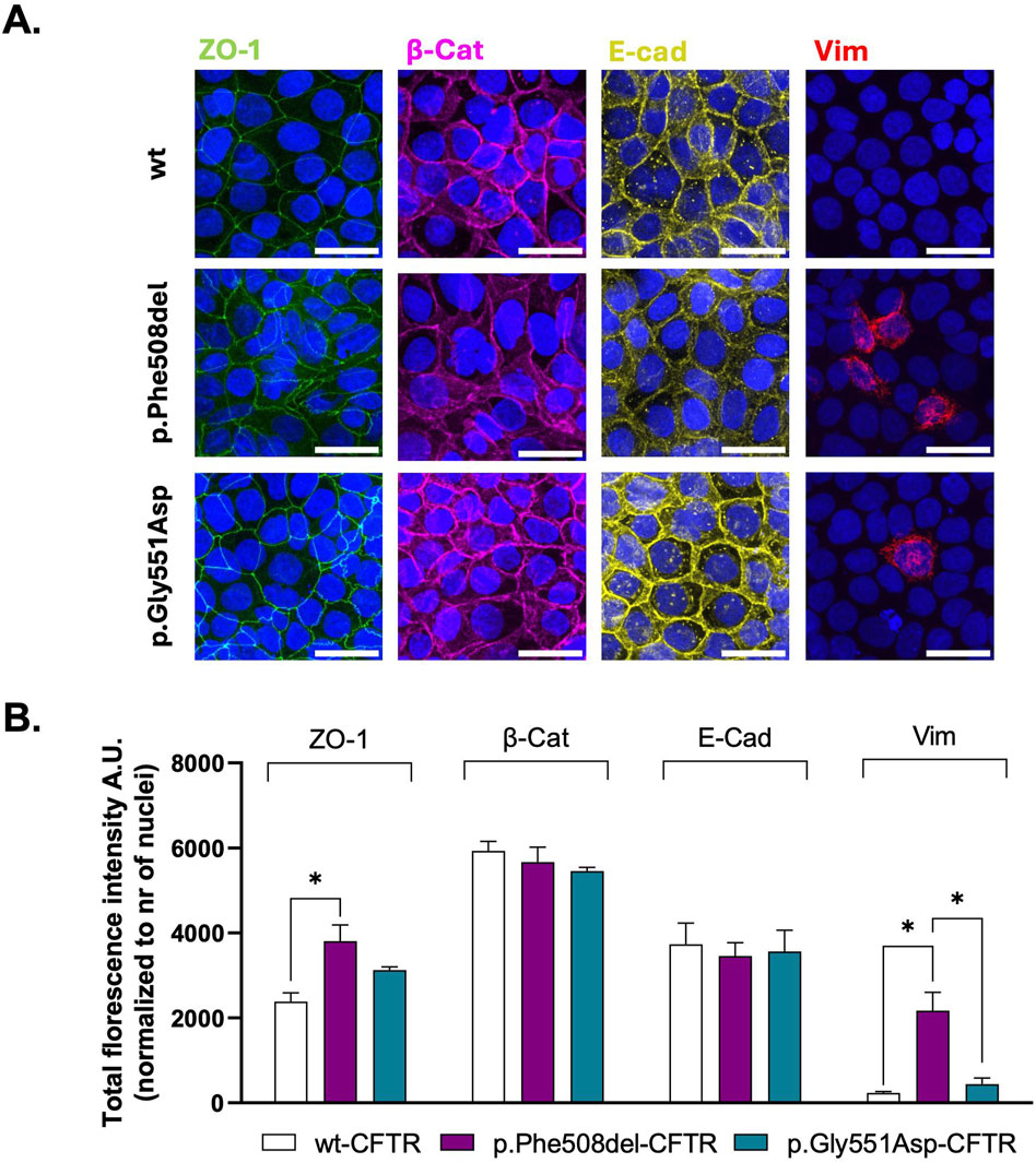 Panel A shows immunofluorescence microscopy images of cells with markers ZO-1 (green), β-Catenin (magenta), E-cadherin (yellow), and Vimentin (red) across wild type, p.Phe508del, and p.Gly551Asp CFTR mutations. Panel B is a bar chart displaying total fluorescence intensity for each marker, normalized to the number of nuclei, comparing wild type, p.Phe508del, and p.Gly551Asp CFTR with notable differences marked by asterisks.