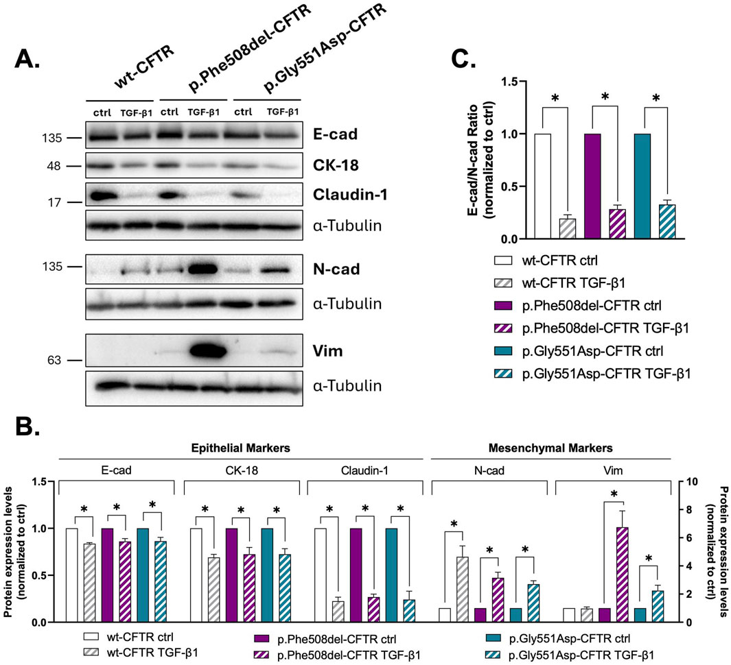 Western blot and bar chart analysis of epithelial and mesenchymal marker proteins. Panel A shows Western blots for markers E-cadherin, CK-18, Claudin-1, N-cadherin, and Vim, with α-Tubulin as loading control, across different CFTR variants and TGF-β1 treatment. Panel B presents bar charts of protein expression levels normalized to control, highlighting significant differences with asterisks. Panel C displays E-cad/N-cad ratio comparisons across treatments. Ctrl denotes control.
