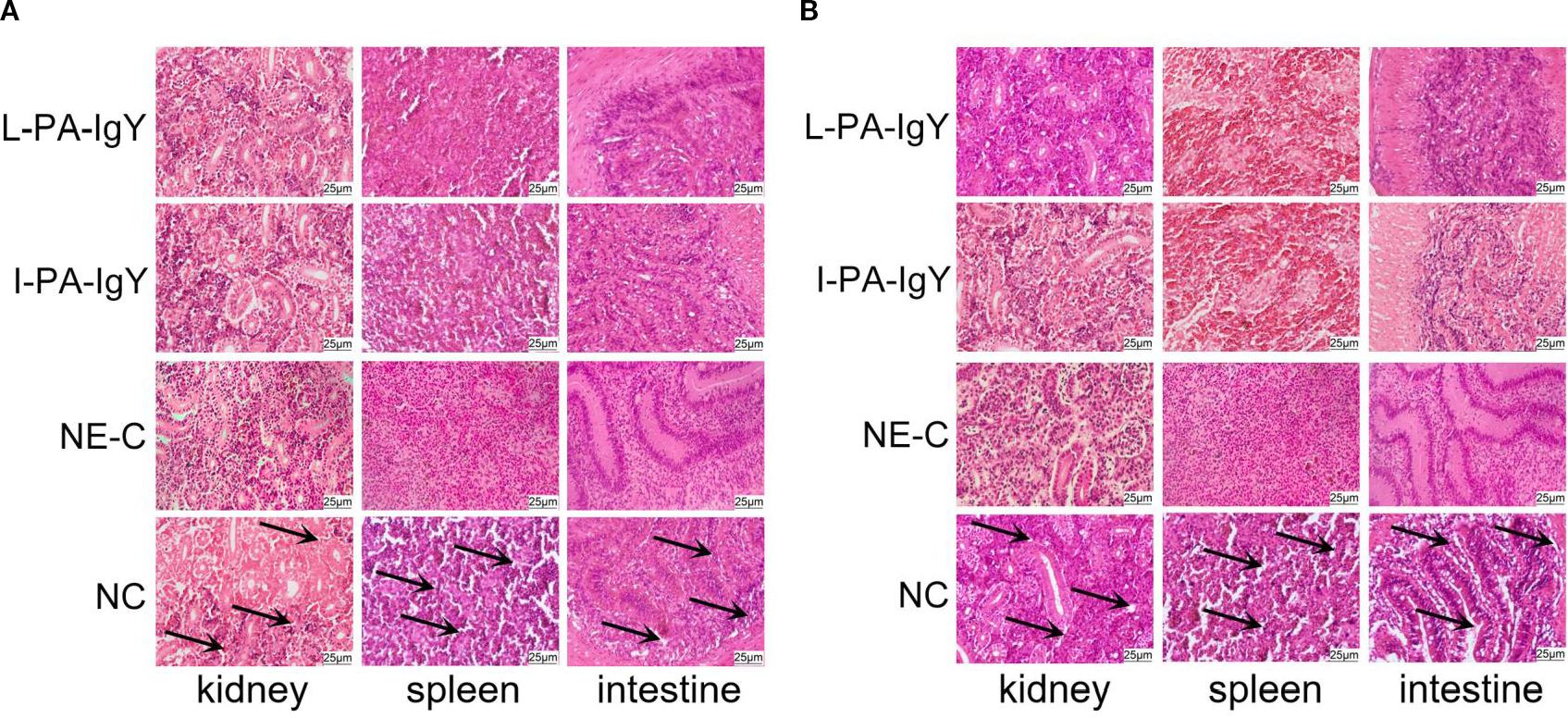 Histological images of kidney, spleen, and intestine tissue under different conditions, labeled L-PA-IgY, I-PA-IgY, NE-C, and NC. Panels A and B display variations in tissue staining, with black arrows indicating specific features in the NC condition. Each image is labeled 25 micrometers for scale.