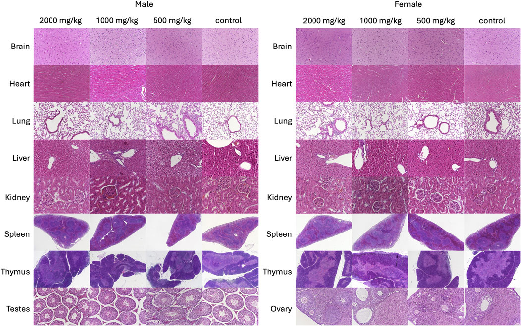 Histological images showing tissue samples from various organs of male and female subjects under different treatments: 2800 mg/kg, 1400 mg/kg, 500 mg/kg doses, and a control group. Organs include the brain, heart, lungs, liver, kidneys, spleen, thymus, and gonads. The images highlight differences in tissue structure and morphology under each condition.