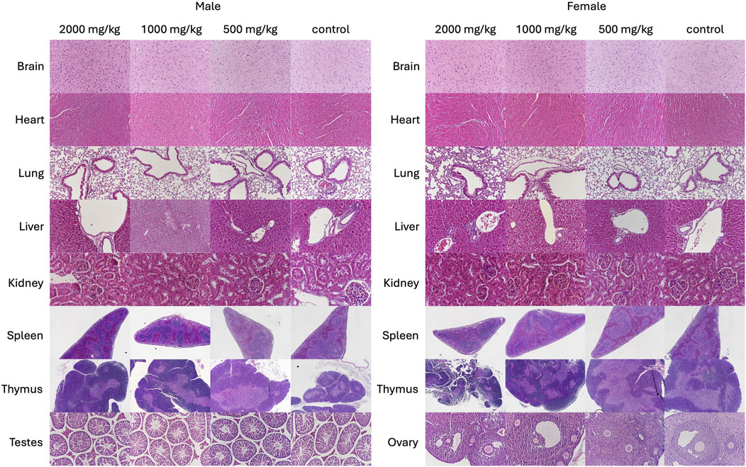 Comparison of histological tissue samples from male and female subjects at different exposure levels: 2800 mg/kg, 1400 mg/kg, 500 mg/kg, and a control group. Tissues examined include brain, heart, lungs, liver, kidneys, spleen, thymus, testes, and ovaries. Each section is stained for microscopic examination to assess potential changes or damage.