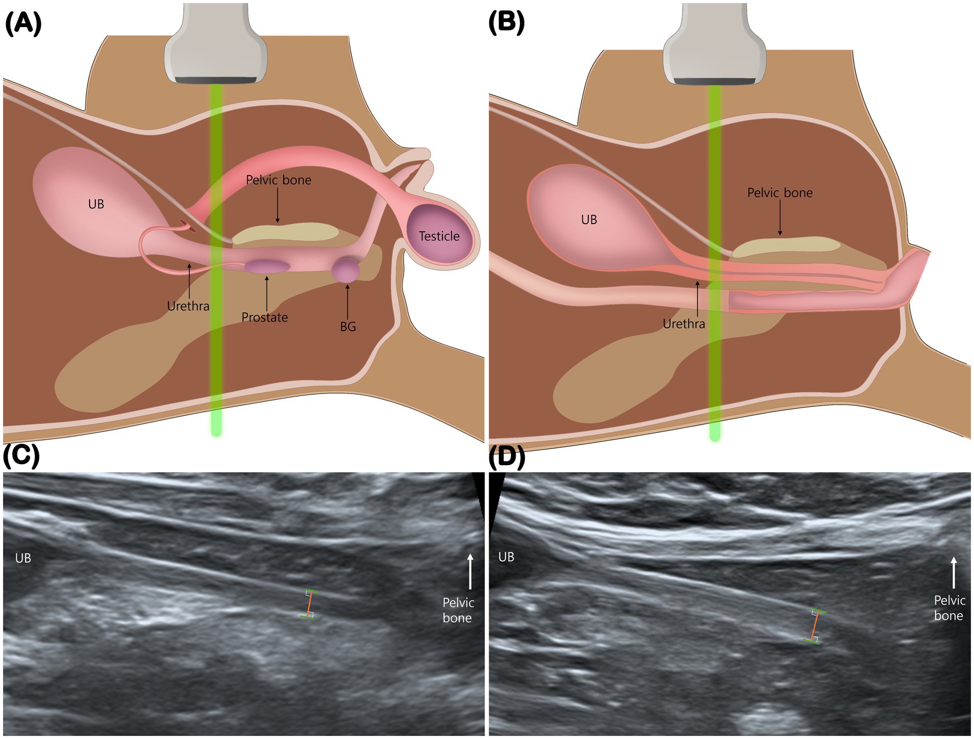 Illustration showing two side-by-side diagrams of male pelvic anatomy in different sections, overlaid with corresponding ultrasound images below. The diagrams depict the urinary bladder, urethra, prostate, testicle, pelvic bone, and bulbourethral gland, with a green line indicating the ultrasound path. Labeled diagram components correspond to features visible in the ultrasounds, showing the urinary bladder and pelvic bone.