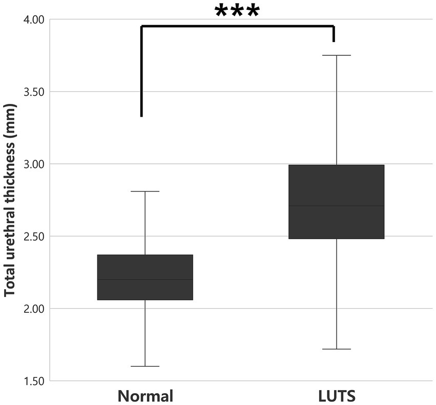 Box plot comparing total urethral thickness in millimeters between normal and LUTS groups. Median thickness is lower in the normal group than in the LUTS group, with significant difference indicated by three asterisks.