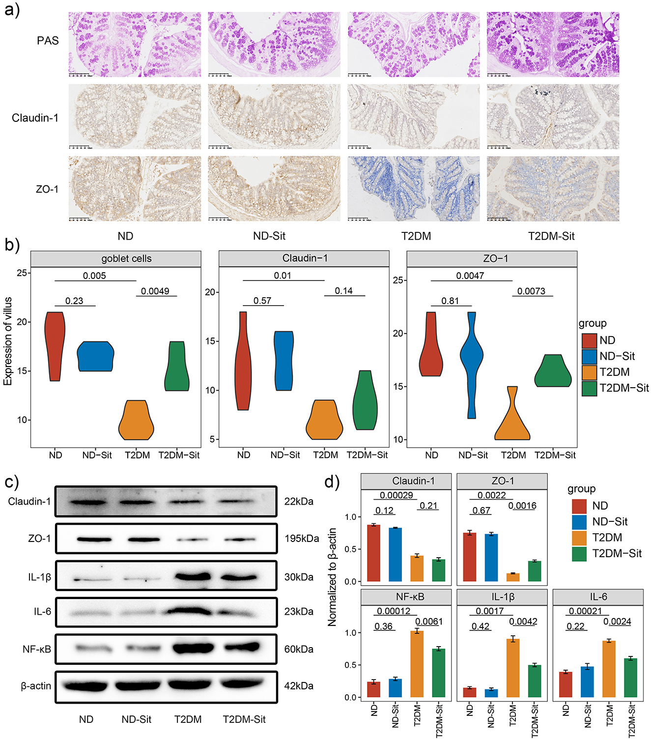 Four-panel figure depicting results related to intestinal villus expression and protein levels across different groups: ND, ND-Sit, T2DM, and T2DM-Sit. Panel (a) shows histological images stained for PAS, Claudin-1, and ZO-1. Panel (b) features violin plots illustrating villus expression levels for goblet cells, Claudin-1, and ZO-1, with statistical significance indicated. Panel (c) presents Western blot analyses for Claudin-1, ZO-1, IL-1β, IL-6, NF-κB, and β-actin, highlighting differences across the groups. Panel (d) displays bar graphs comparing protein normalization to β-actin, with significant p-values annotated.
