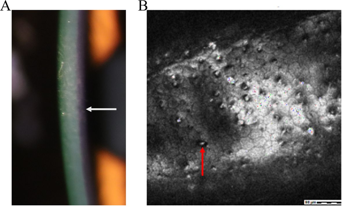 Panel A shows a close-up image of a green and orange structure with an arrow pointing toward its surface. Panel B displays a grayscale microscopic image with a red arrow indicating a central darker spot among a textured area.