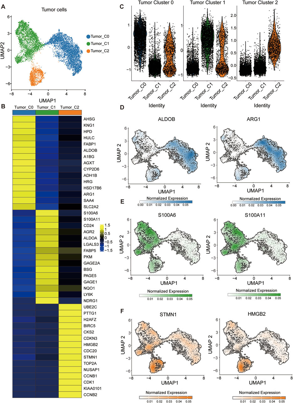 Cluster analysis of tumor cells using UMAP plots and violin plots. Panel A shows UMAP distribution of three tumor cell clusters: Tumor_C0 (blue), Tumor_C1 (green), and Tumor_C2 (orange). Panel B presents a heatmap of gene expression across the clusters. Panel C includes violin plots for Tumor Cluster 0, Tumor Cluster 1, and Tumor Cluster 2 showing cluster identity. Panels D, E, and F display UMAP plots with normalized expression of specific genes: ALDOB, ARG1, S100A6, S100A11, STMN1, and HMGB2, illustrating expression patterns within the clusters.