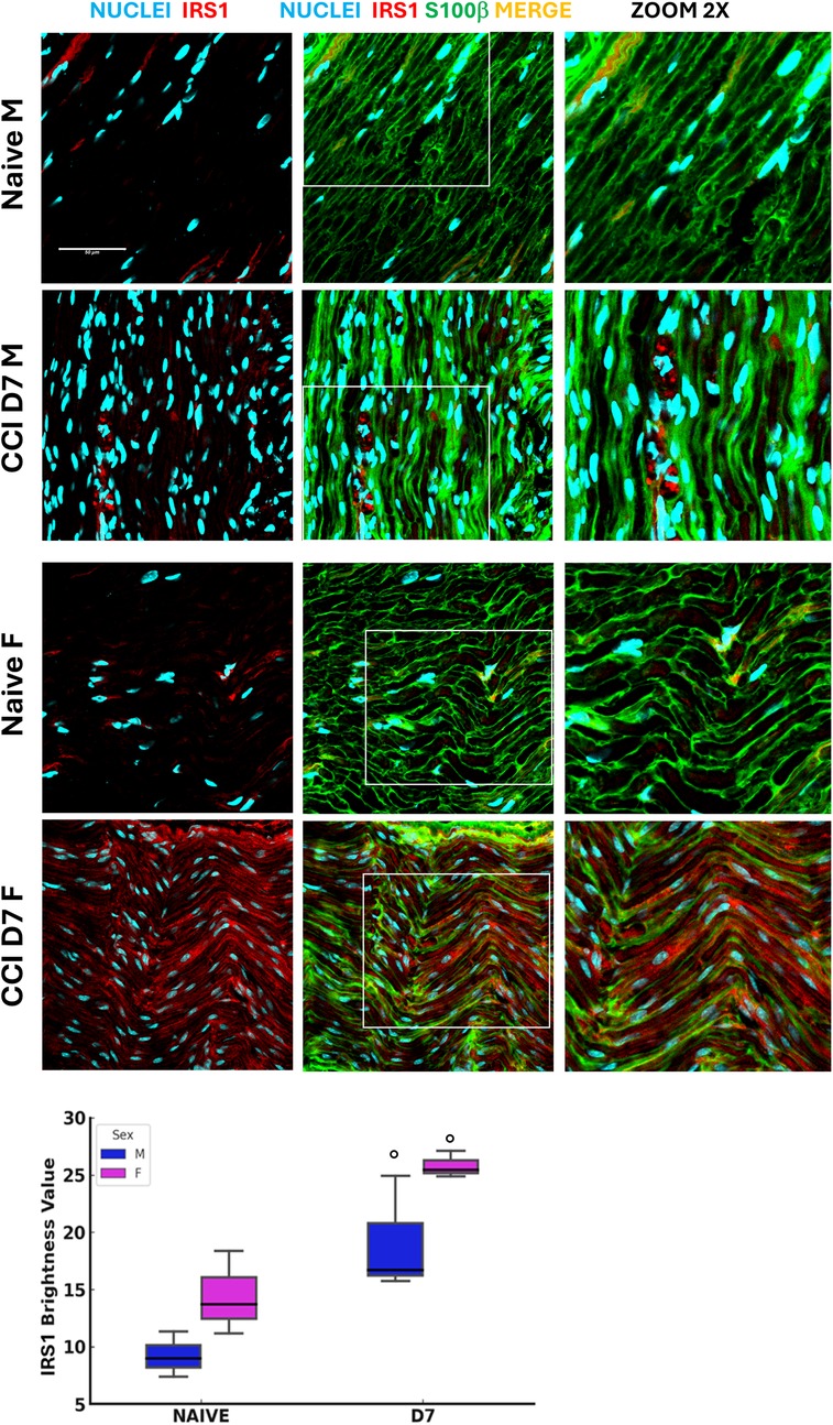 Microscopic images display immunofluorescent staining of tissues, with nuclei in blue, IRS1 in red, and S100β in green across different conditions titled Naïve and CCI D7, separated by male (M) and female (F) samples. The magnified merge shows detailed cellular structure and protein localization. Below, a box plot illustrates IRS1 brightness values comparing naive and D7 conditions for both sexes, indicating increased expression over time.