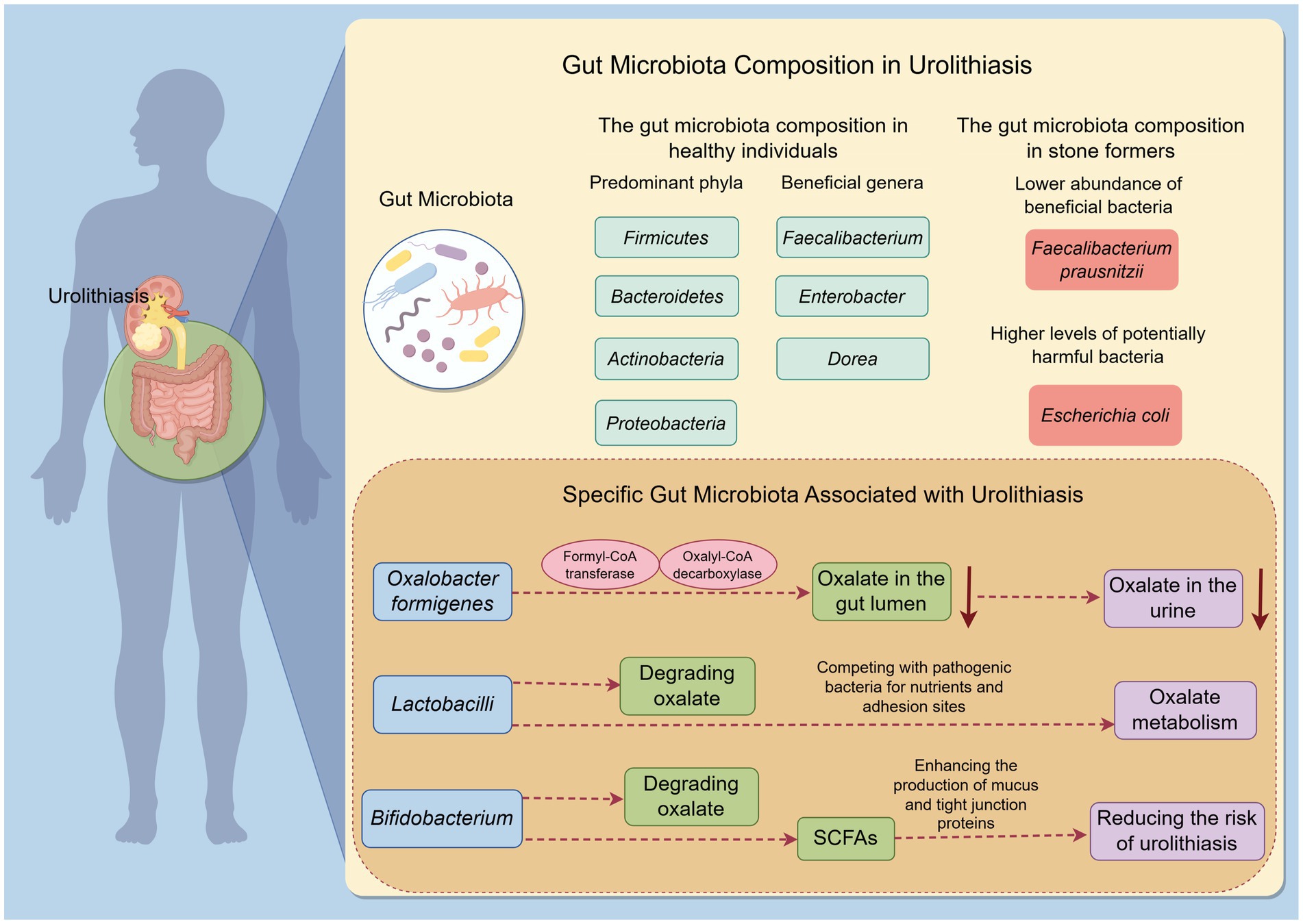 Illustration showing gut microbiota composition in urolithiasis. A human silhouette with digestive organs highlights urolithiasis. Healthy individuals have predominant phyla: Firmicutes, Bacteroidetes, Actinobacteria, Proteobacteria; beneficial genera: Faecalibacterium, Enterobacter, Dorea. Stone formers have lower Faecalibacterium prausnitzii, higher Escherichia coli. Specific microbiota like Oxalobacter formigenes, Lactobacilli, Bifidobacterium degrade oxalate, affecting oxalate in the gut lumen and urine, competing with pathogenic bacteria, enhancing SCFAs production, reducing urolithiasis risk.