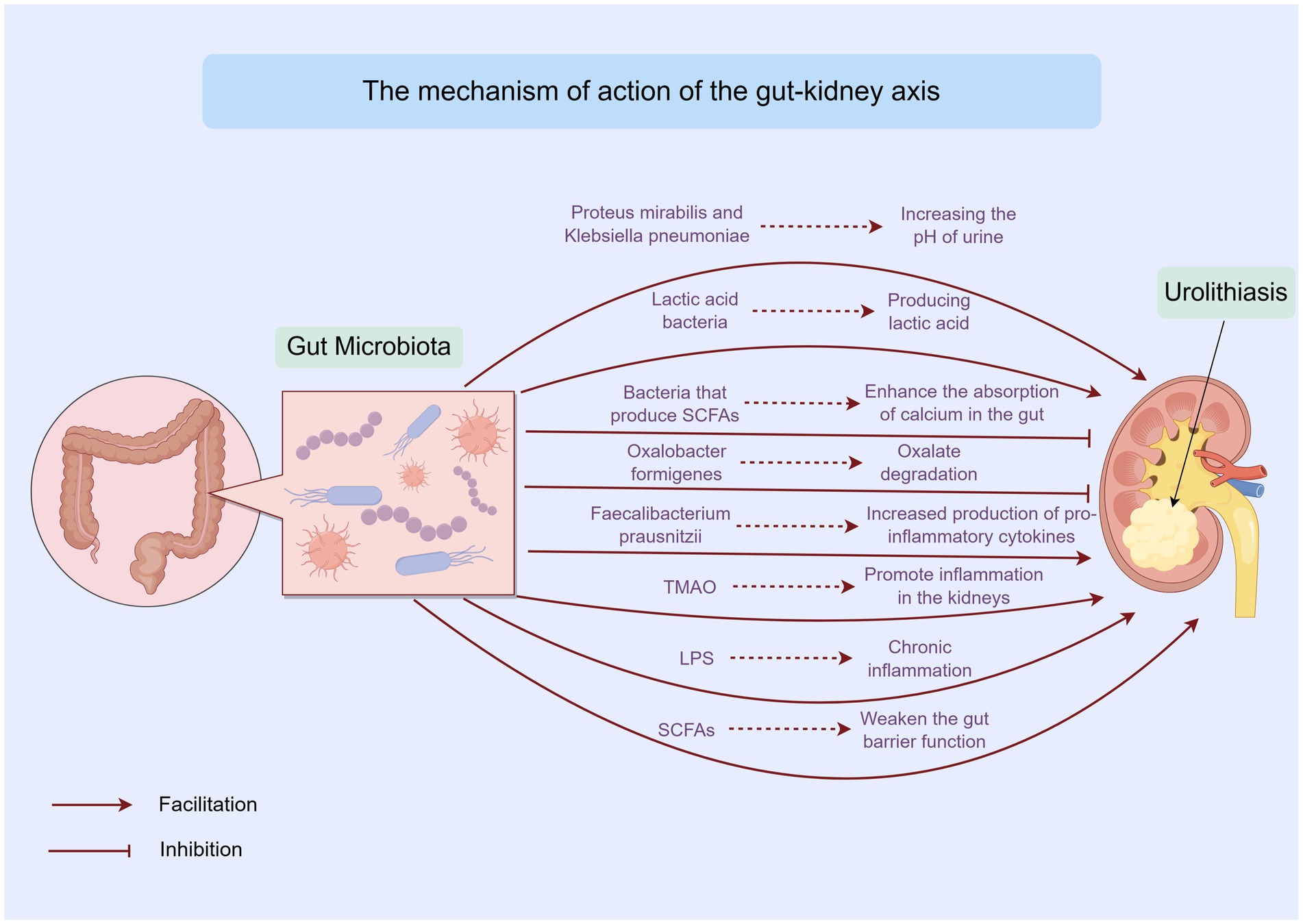 Diagram illustrating the mechanism of action of the gut-kidney axis. It shows gut microbiota affecting the kidneys through various pathways: Proteus mirabilis increases urine pH, lactic acid bacteria produce lactic acid, bacteria produce SCFAs to enhance calcium absorption, and other bacteria like Oxalobacter formigenes and Faecalibacterium prausnitzii influence inflammation. TMAO and LPS promote inflammation, while SCFAs weaken gut barrier function. Urolithiasis is shown as an effect on the kidneys. Facilitation and inhibition pathways are indicated.