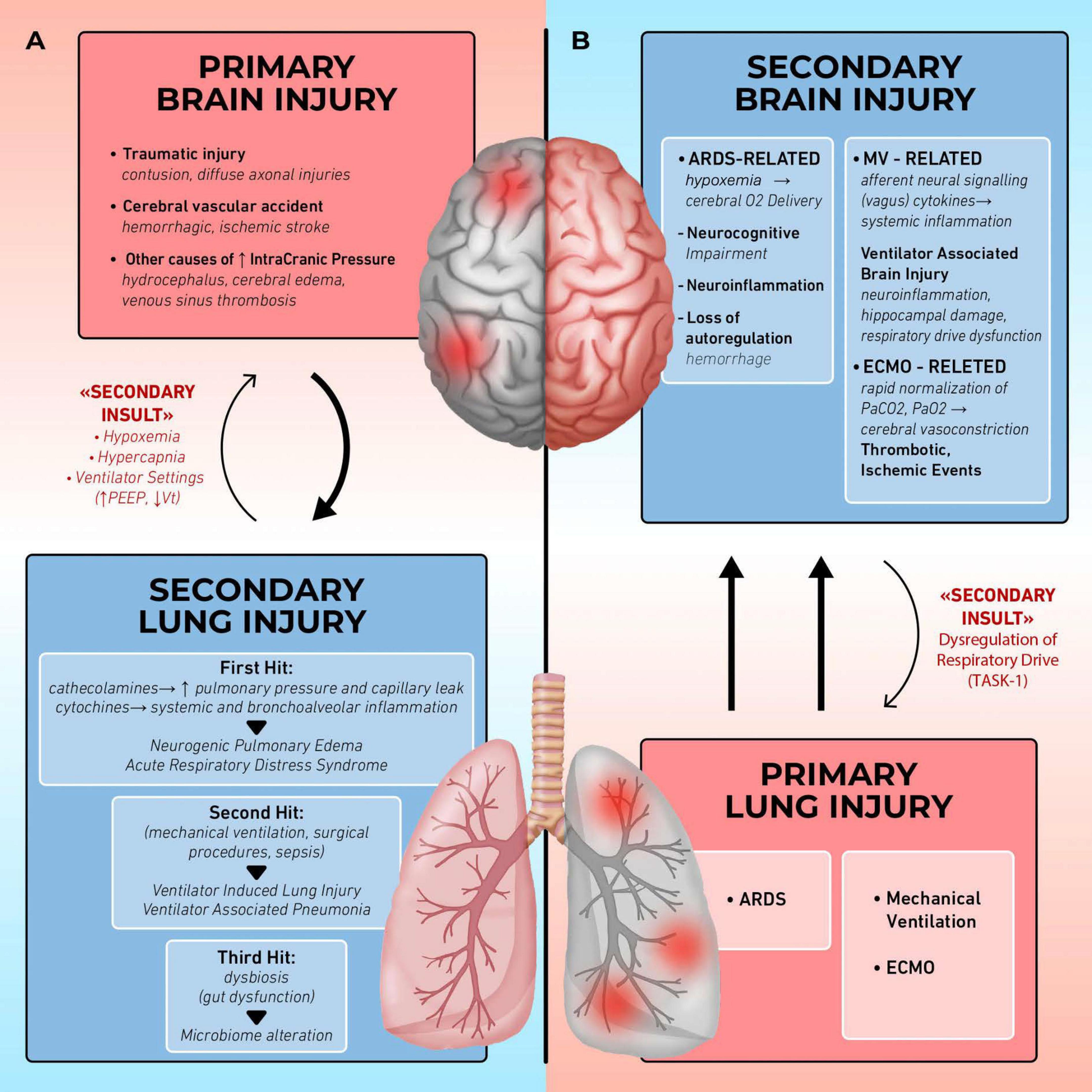 Diagram illustrating the cycle between brain and lung injuries. On the left, primary brain injury causes secondary lung injury through secondary insults like hypoxemia. On the right, primary lung injury leads to secondary brain injury via secondary insults like dysregulation of respiratory drive. Both primary brain injury and primary lung injury have their respective causes and effects detailed in bullet points within pink and blue boxes. The brain and lungs are depicted centrally, highlighting the connection between the two injury types.