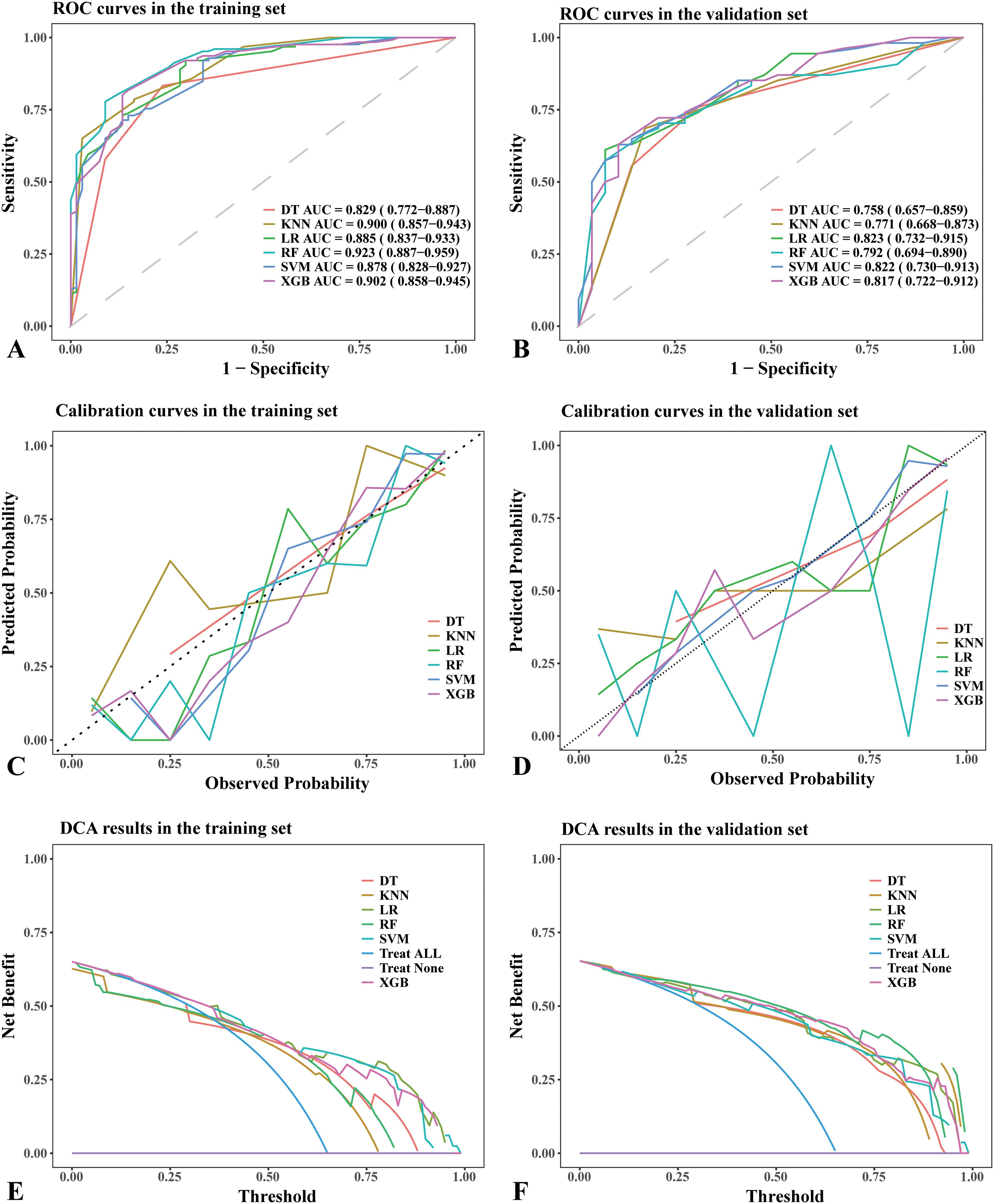 Six charts display model performance metrics for training and validation sets. A and B show ROC curves, illustrating sensitivity versus specificity for different models. C and D present calibration curves, comparing predicted versus observed probabilities. E and F depict decision curve analysis results, highlighting net benefit across thresholds for various models: DT, KNN, LR, RF, SVM, and XGB.
