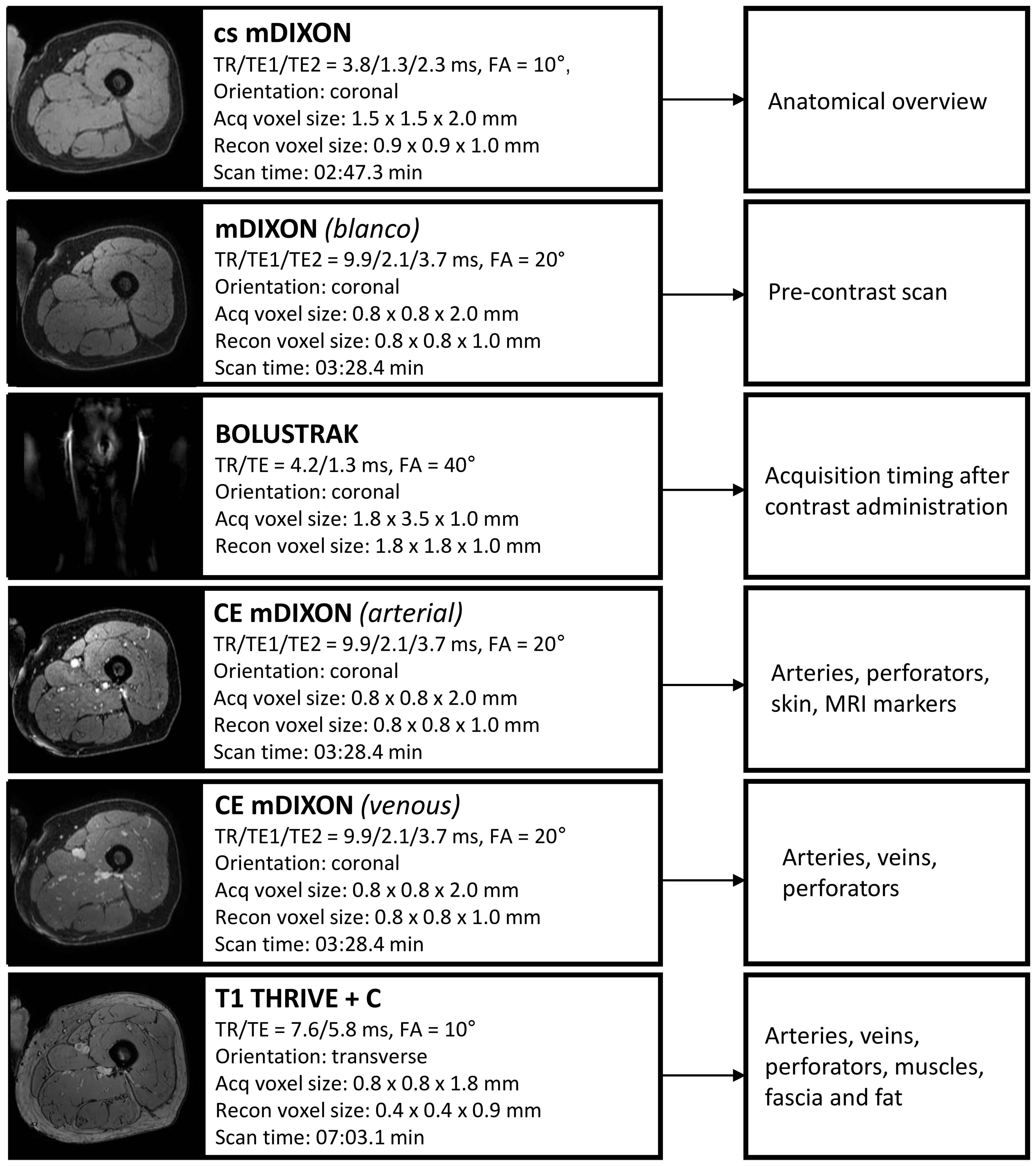 Magnetic Resonance Imaging (MRI) sequences displayed in a table format, each with specific technical parameters and corresponding purposes. The sequences include cs_mDIXON for anatomical overview, mDIXON (blanco) for precontrast scans, BOLUSTRACK for acquiring timing after contrast administration, CE mDIXON (arterial and venous) for visualizing arteries, veins, perforators, MRI markers, and skin, and T1 THRIVE + C for arteries, veins, perforators, muscles, fascia, and fat. The parameters detail TR, TE, voxel sizes, orientation, and scan times. Images accompany each sequence, showing corresponding MRI scans.