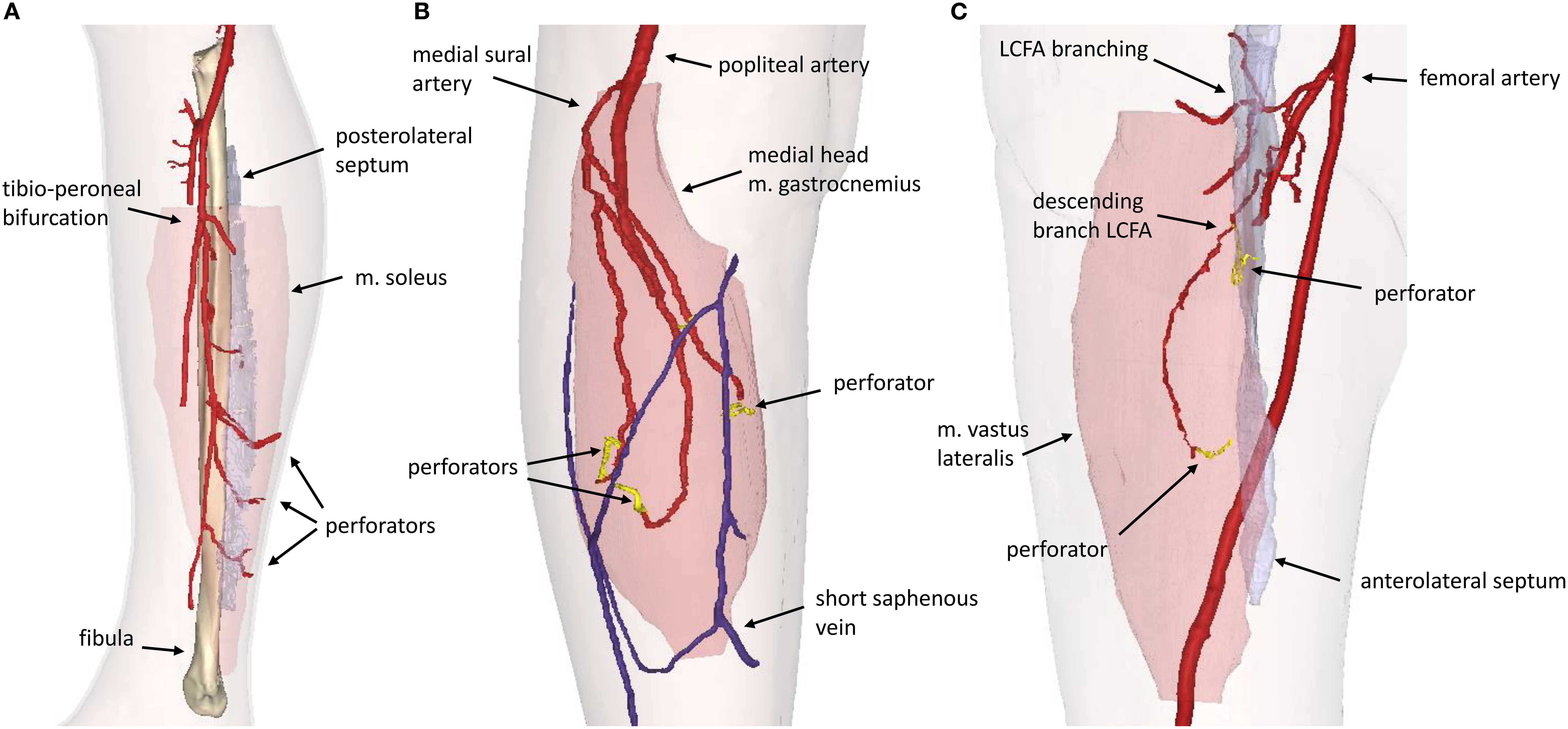 Diagram illustrating the arterial and venous systems of the lower leg. Panel A shows the fibula, tibio-peroneal bifurcation, perforators, posterolateral septum and soleus muscle. Panel B highlights the medial sural artery, perforators, medial head of gastrocnemius, and short saphenous vein. Panel C displays the femoral artery, lateral circumflex femoral artery (LCFA) branches, perforators, vastus lateralis muscle and anterolateral septum. Red indicates arteries, blue indicates veins, and yellow marks perforators.