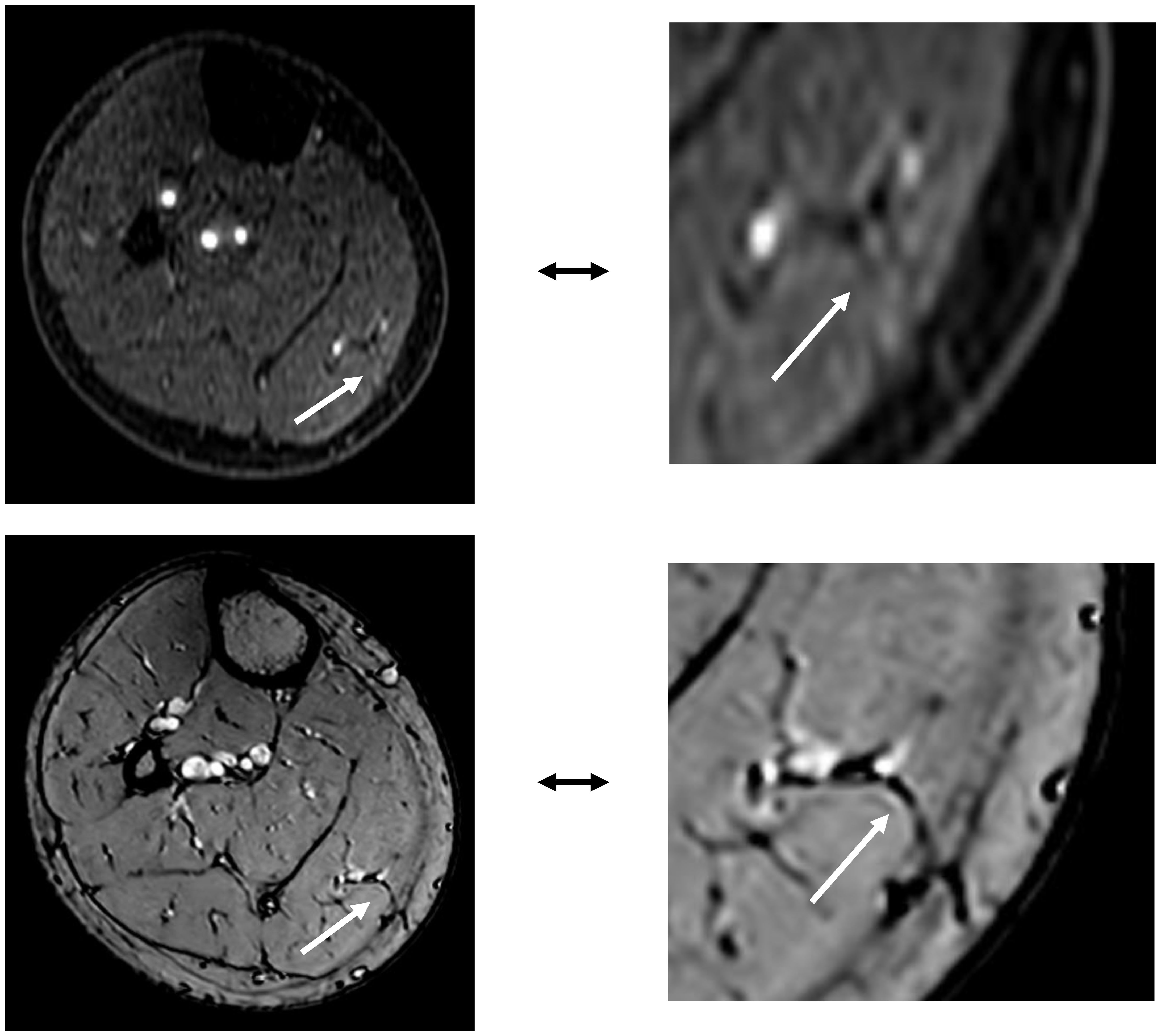 MRI scans show cross-sectional images of tissue, with arrows indicating specific areas of interest on each image. Two panels compare detailed sections with enlarged views.