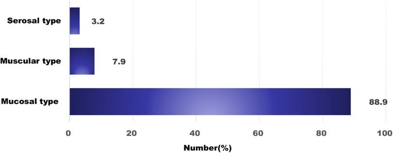 Bar chart displaying the percentage distribution of three types: Serosal type at 3.2 percent, Muscular type at 7.9 percent, and Mucosal type at 88.9 percent.