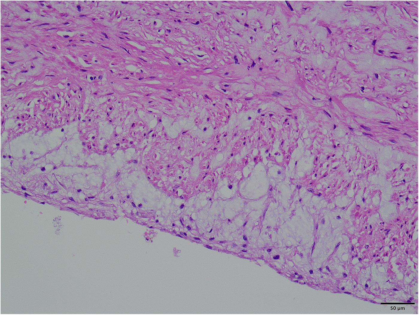 Microscopic view of tissue stained with hematoxylin and eosin, showing dense fibrous connective tissue in pink and numerous scattered cells with purple nuclei, indicating cellular distribution. Scale bar indicates fifty micrometers.