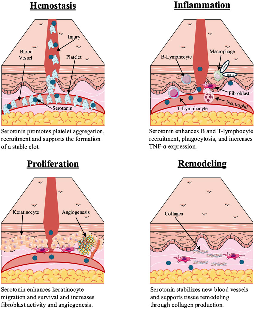 Illustration of four phases of wound healing: Hemostasis, Inflammation, Proliferation, and Remodeling. Hemostasis shows blood vessel injury, platelet aggregation, and serotonin aiding clot formation. Inflammation depicts B and T-lymphocyte recruitment, macrophages, neutrophils, and increased TNF-alpha expression. Proliferation highlights keratinocyte migration and angiogenesis, with serotonin enhancing fibroblast activity. Remodeling exhibits collagen production for tissue remodeling and blood vessel stabilization. Each phase includes serotonin’s role and supporting text.
