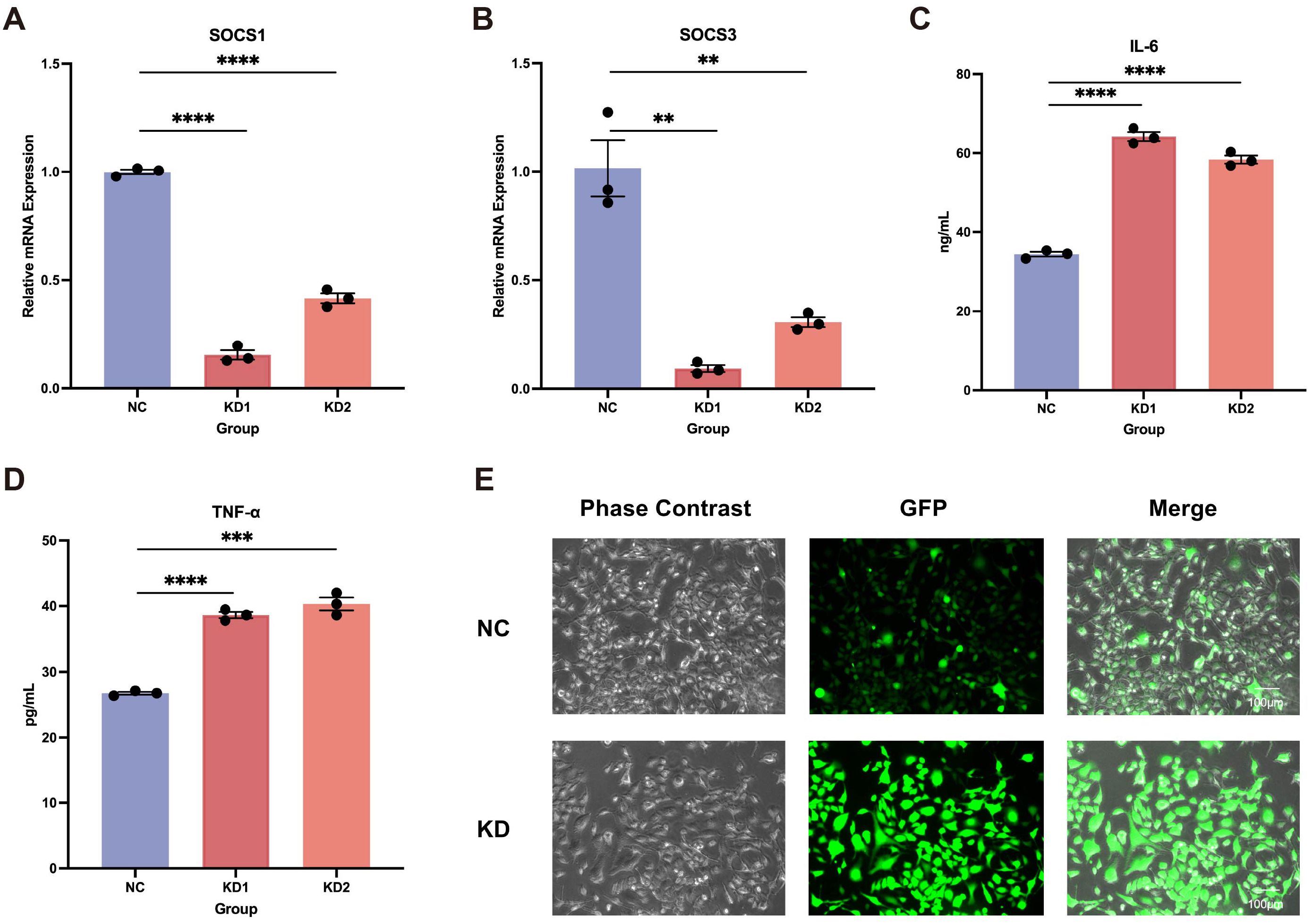Bar graphs and images showing experimental results. Panels A and B display SOCS1 and SOCS3 mRNA expression for NC, KD1, and KD2 groups. Panel C shows IL-6 levels and Panel D shows TNF-α levels in the same groups. Stars indicate significance levels. Panel E showcases phase contrast and GFP images with merged views for NC and KD groups.