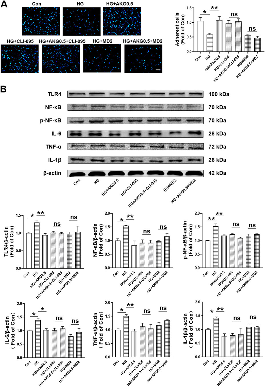 Panel A shows fluorescence microscopy images of adherent cells under different conditions: Con, HG, HG+AKG0.5, HG+CLI-095, HG+AKG0.5+CLI-095, HG+MD2, and HG+AKG0.5+MD2. A bar graph compares cell adhesion levels, noting statistical significance with asterisks. Panel B presents Western blot results for proteins TLR4, NF-kB, p-NF-kB, IL-6, TNF-α, IL-1β, and β-actin across the same conditions. Six corresponding bar graphs show protein expression levels, highlighting significant changes with asterisks.