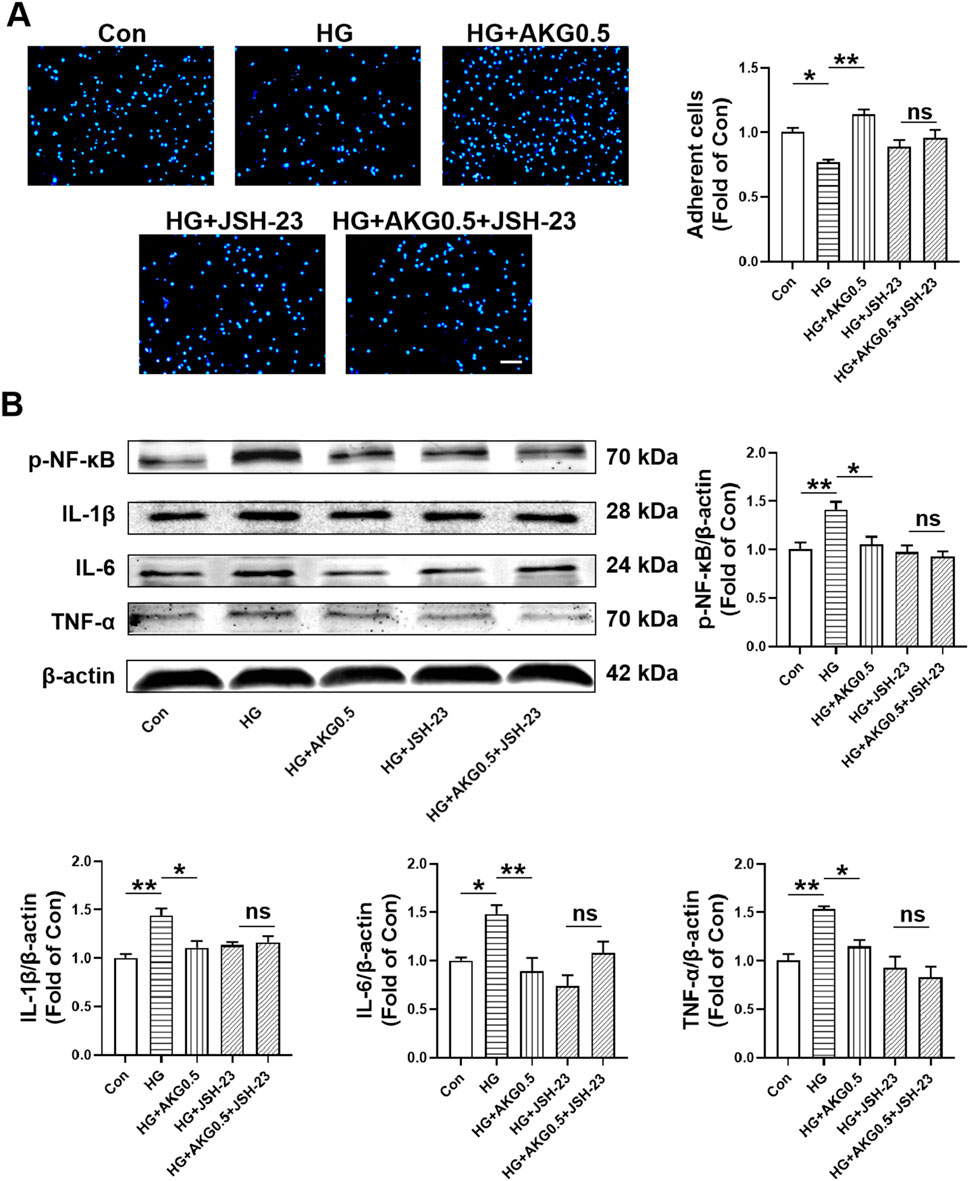 Panel A shows images of cells under different conditions: Con, HG, HG + AKG 0.5, HG + JSH-23, and HG + AKG 0.5 + JSH-23. A bar graph indicates a significant increase in adherent cells for HG + AKG 0.5 compared to controls, indicated by asterisks. Panel B displays Western blot results for p-NF-κB, IL-1β, IL-6, and TNF-α. Corresponding bar graphs show significant increases in these proteins under HG conditions, with some reduction upon treatment with AKG and JSH-23 inhibitors. Error bars denote standard deviation, and asterisks indicate statistical significance.