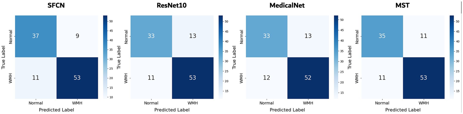 Four confusion matrices compare the performance of different models: SFCN, ResNet10, MedicalNet, and MST. Each matrix shows true labels (Normal, WMH) versus predicted labels. Numbers in quadrants indicate the count of predictions: SFCN (37, 9, 11, 53), ResNet10 (33, 13, 11, 53), MedicalNet (33, 13, 12, 52), MST (35, 11, 11, 53). A color gradient indicates magnitude, from light to dark blue.