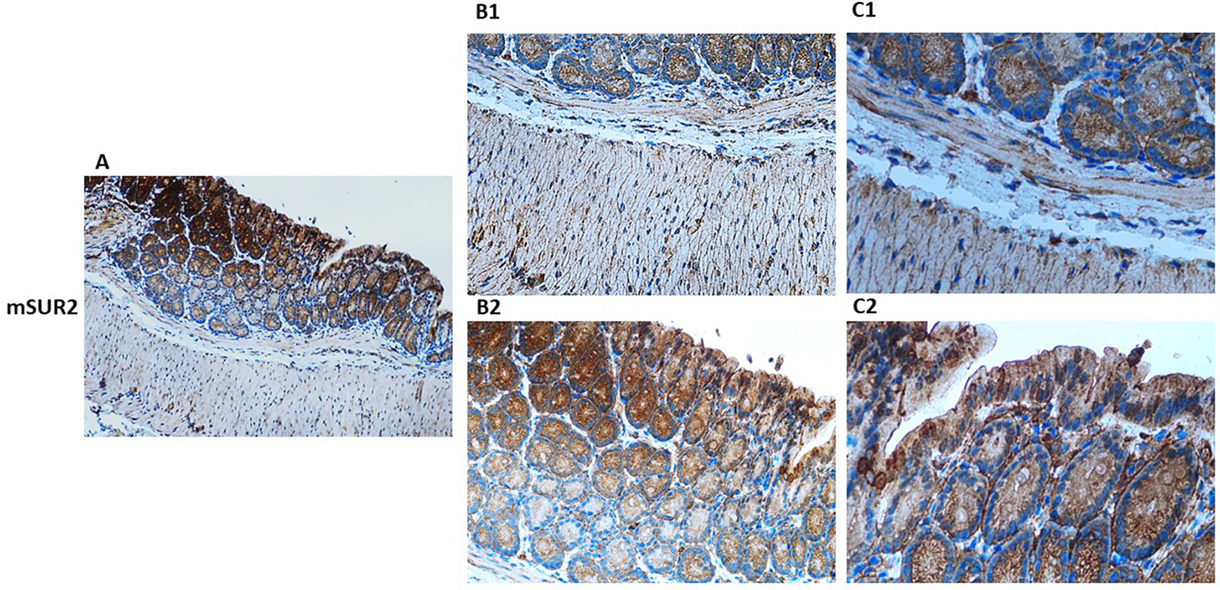 Microscopic images showing two groups, hKir6.2 and hSUR2, labeled A, A1, B, and B1. Each section reveals cell structures with varying staining patterns, highlighting cellular and tissue detail differences. The sections are stained to differentiate morphological features.