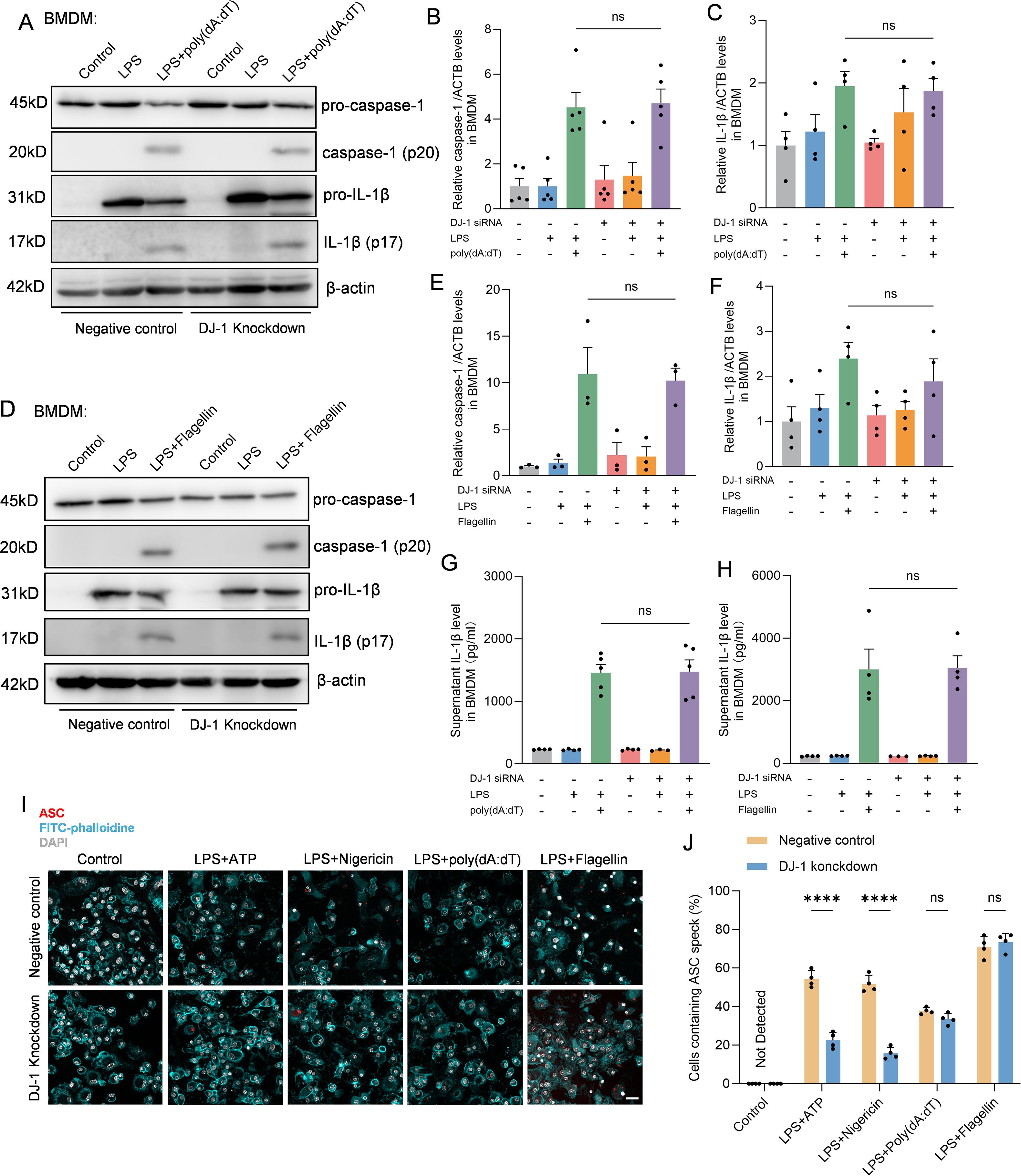 Western blot and bar chart panels showing the effects of DJ-1 knockdown in BMDMs. Panels A and D display Western blots analyzing protein levels of pro-caspase-1, caspase-1, pro-IL-1β, IL-1β, and β-actin under various treatments. Bar charts (B, C, E, F) represent relative protein levels, indicating statistical significance with “ns” for not significant. Panels G and H show IL-1β levels in BMDM supernatants. Panel I displays immunofluorescence images of ASC, phalloidin, and DAPI staining with various treatments. Chart J quantifies ASC speck formation in cells. Bars are labeled for negative control and DJ-1 knockdown comparisons.