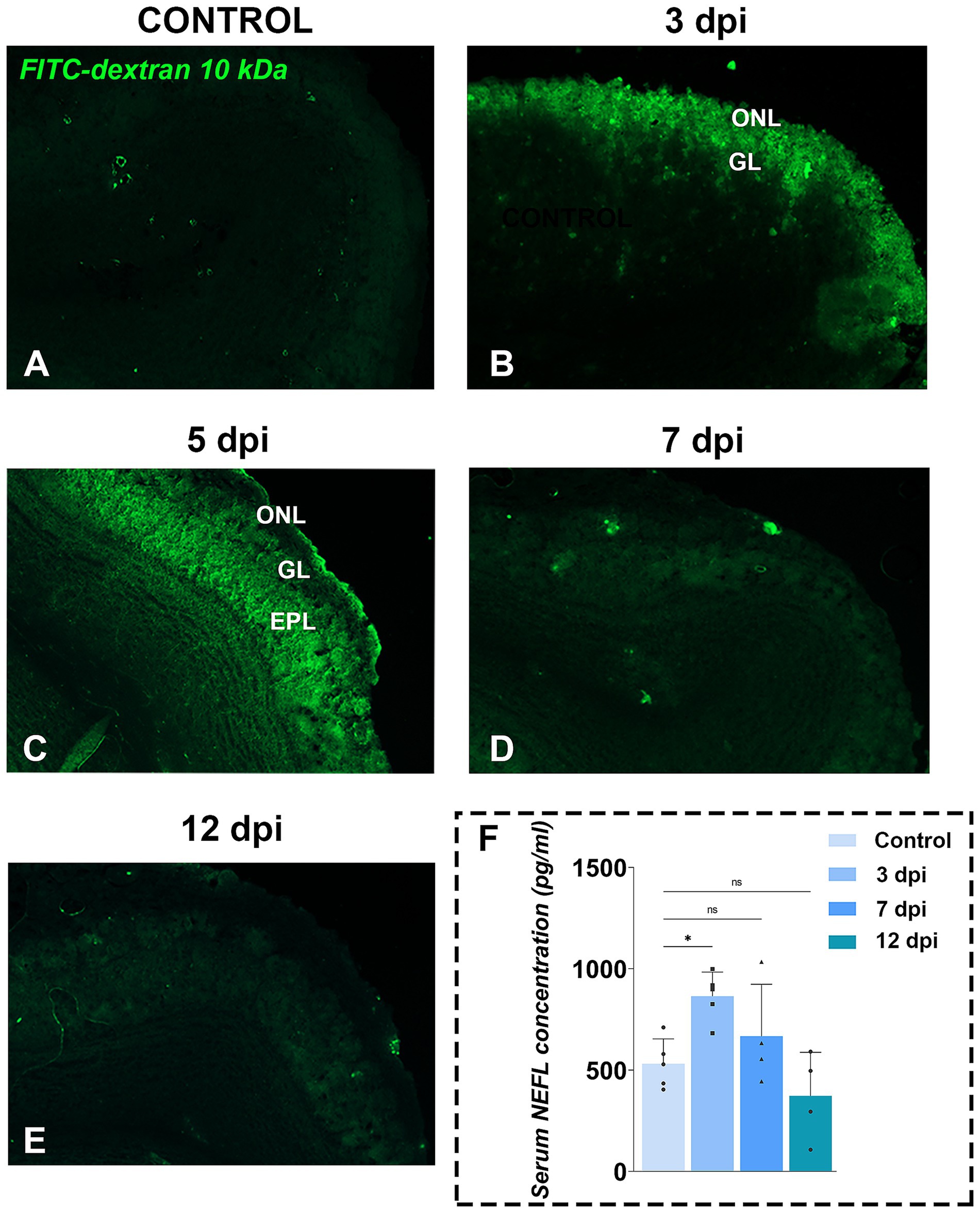 Fluorescent micrographs and a bar chart depict findings at various days post-immunization (dpi). Images labeled A to E show green fluorescence in the olfactory bulb (OB) tissue, highlighting regions like ONL (olfactory nerve layer), GL (glomerular layer), and EPL (external plexiform layer) under control and at 3, 5, 7, and 12 dpi. Image F presents a bar chart illustrating serum NEFL concentration in picograms per milliliter, comparing control and subsequent dpi points, with statistical notations indicating significance levels.