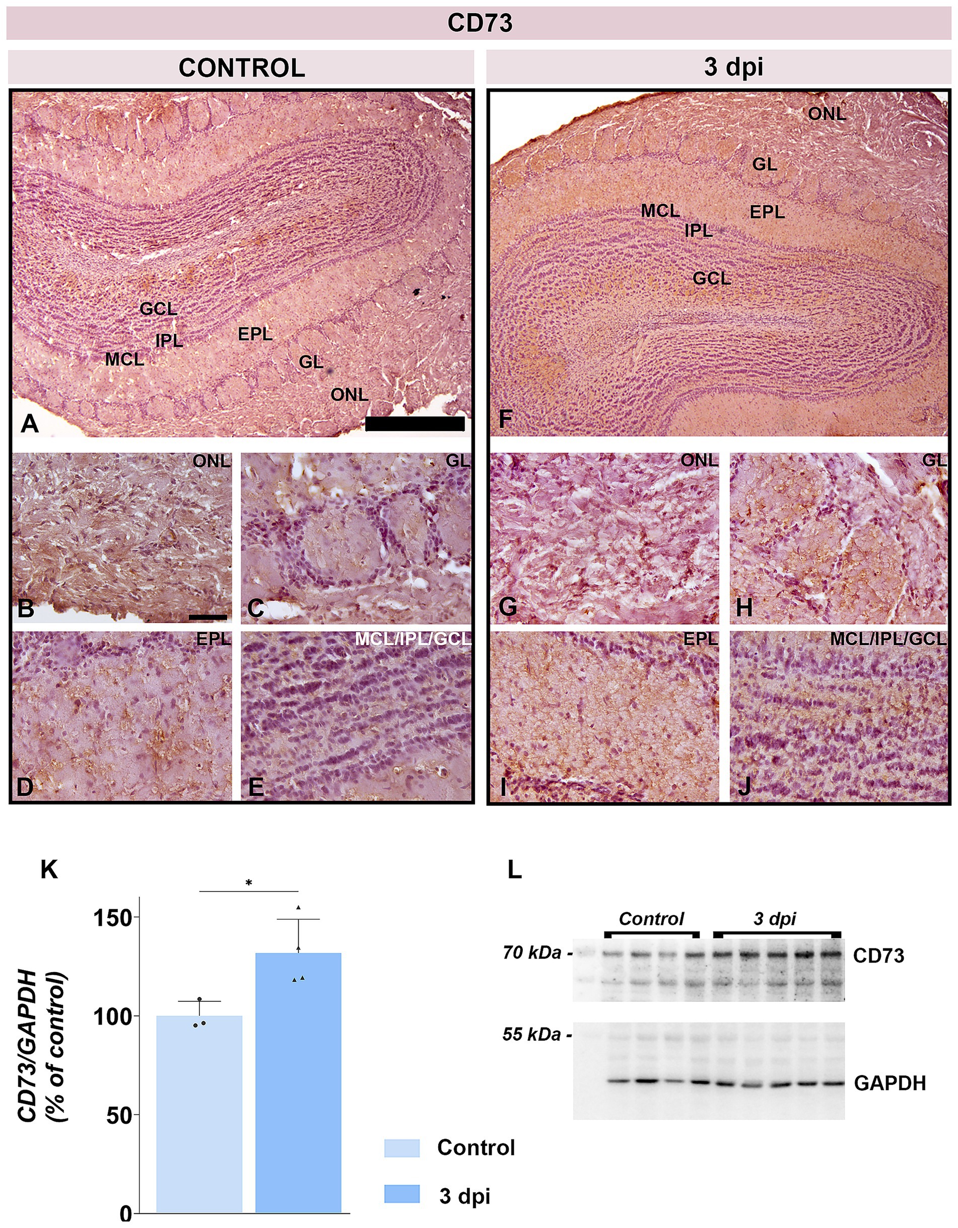 Histological comparison of CD73 in control and 3 days post-imunization OB tissue, labeled with ONL, GL, EPL, MCL, IPL, and GCL layers. Panels A-E show control samples; F-J show 3 dpi samples, with notable CD73 expression differences. Panel K presents a bar graph indicating increased CD73/GAPDH levels in 3 dpi samples. Panel L shows a Western blot analysis, with higher CD73 protein levels in 3 dpi compared to control.