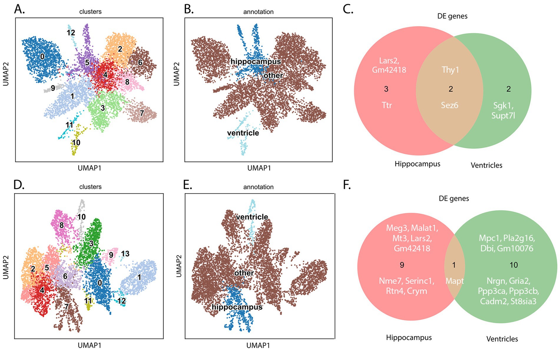 Diagram illustrating a study on mouse brain sections. Top panel shows wild-type and THY-Tau22 mice with brain slices. Middle panel details spatial transcriptomics, displaying gene expression grids, a gene interaction network highlighting Ttr, and heatmaps for THY-Tau22 and wild-type mice. Bottom panel depicts immunofluorescence in ventricle and hippocampus, showing increased TTR in THY-Tau22 and decreased TTR in TauKO, with fluorescence images of tissue sections.