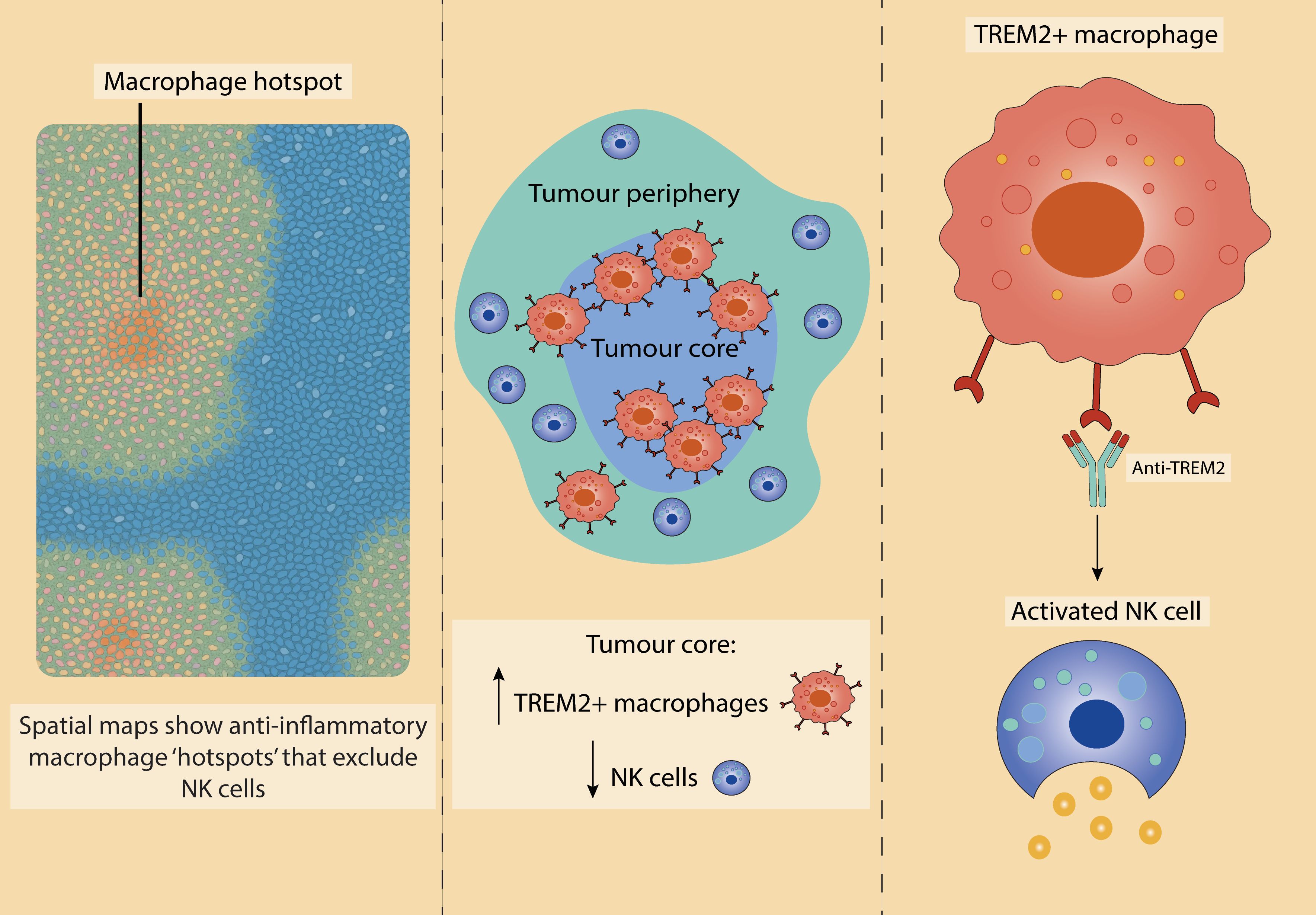 Diagram illustrating macrophage hotspots and their impact on natural killer (NK) cells. The left panel shows spatial maps with anti-inflammatory macrophage hotspots excluding NK cells. The middle panel depicts a tumor core with TREM2+ macrophages densely present, and NK cells mostly on the periphery. The right panel illustrates a TREM2+ macrophage interacting with anti-TREM2, activating an NK cell, shown by the release of particles. The graphic highlights the dynamics between macrophages and NK cells in tumor environments.